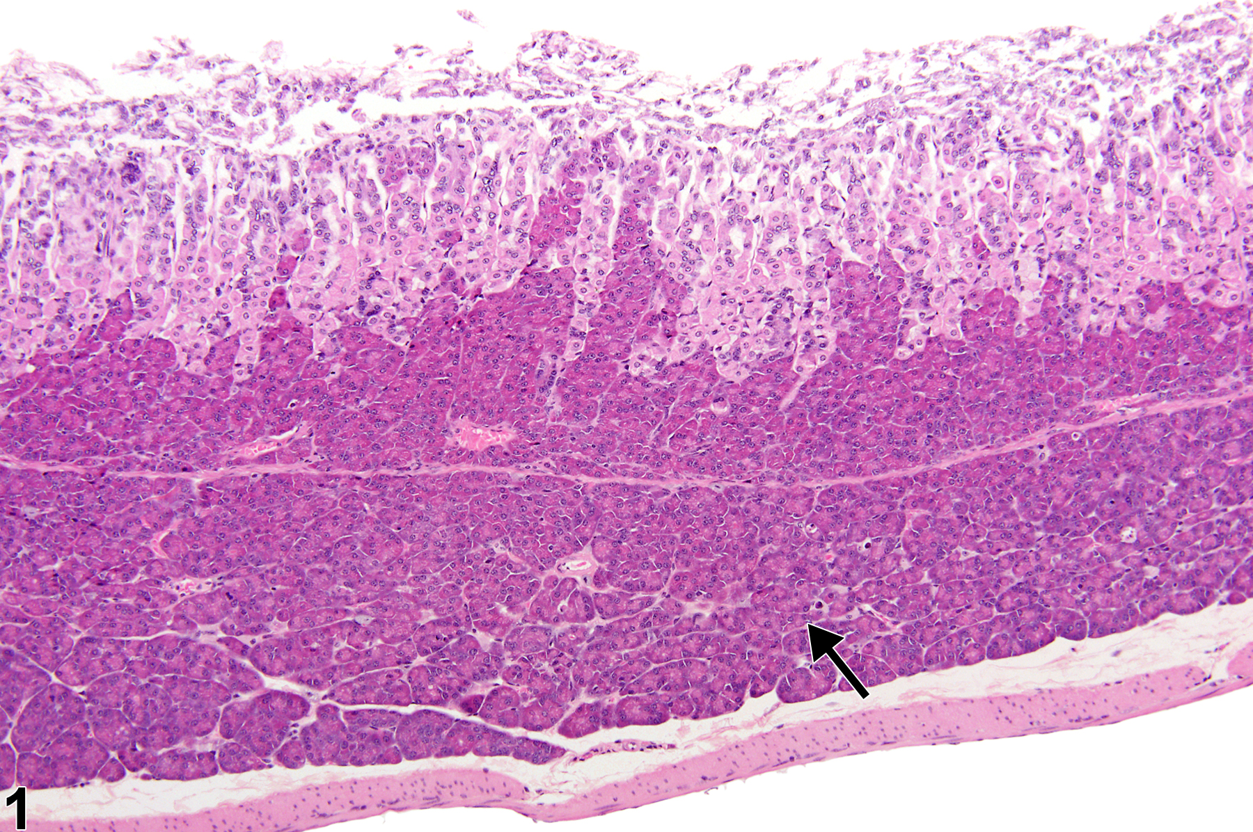 Image of ectopic tissue (pancreas) in the glandular stomach from a female B6C3F1 mouse in a chronic study