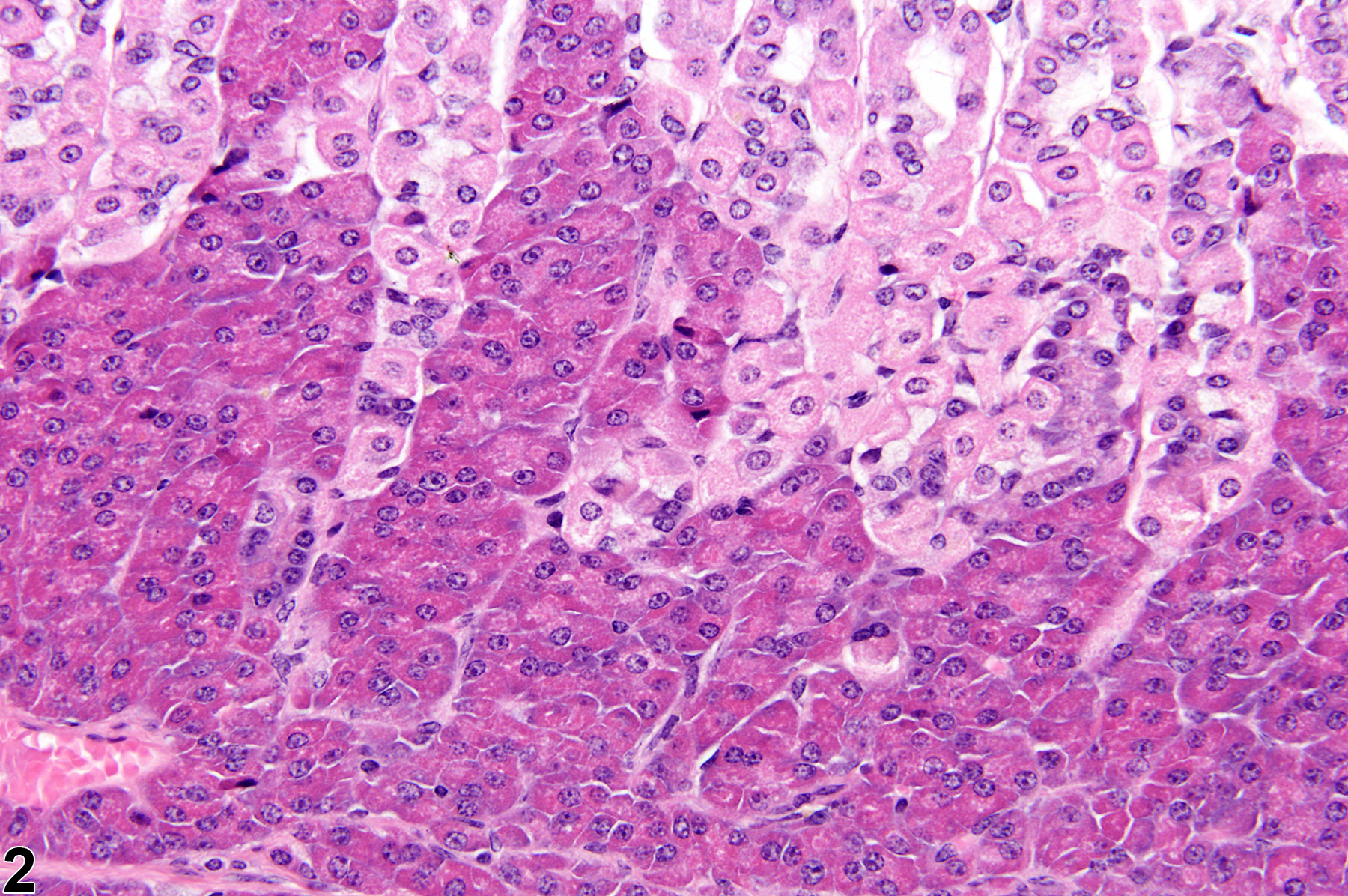Image of ectopic tissue (pancreas) in the glandular stomach from a female B6C3F1 mouse in a chronic study