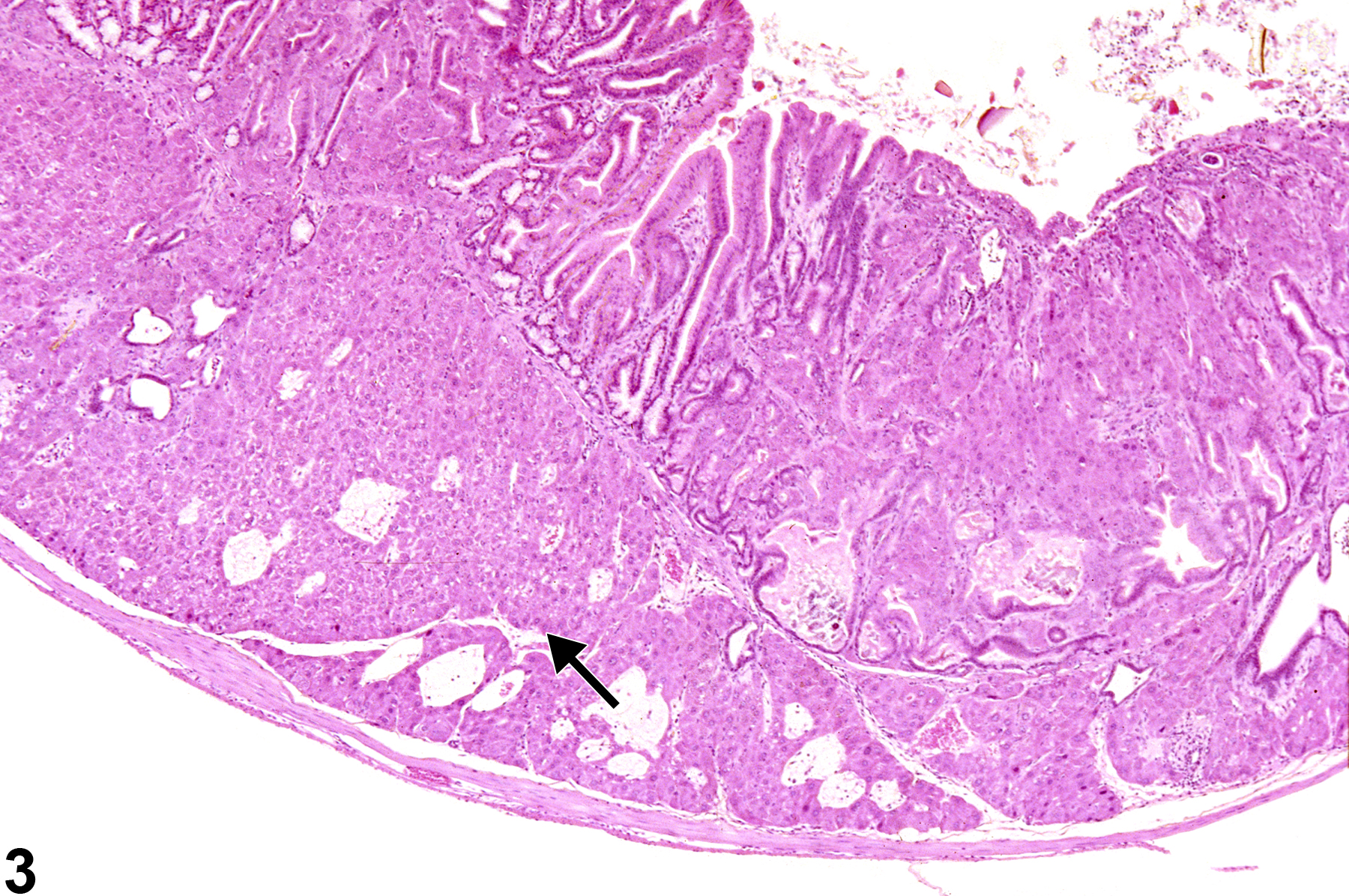 Image of ectopic tissue (liver) in the glandular stomach from a female B6C3F1 mouse in a chronic study