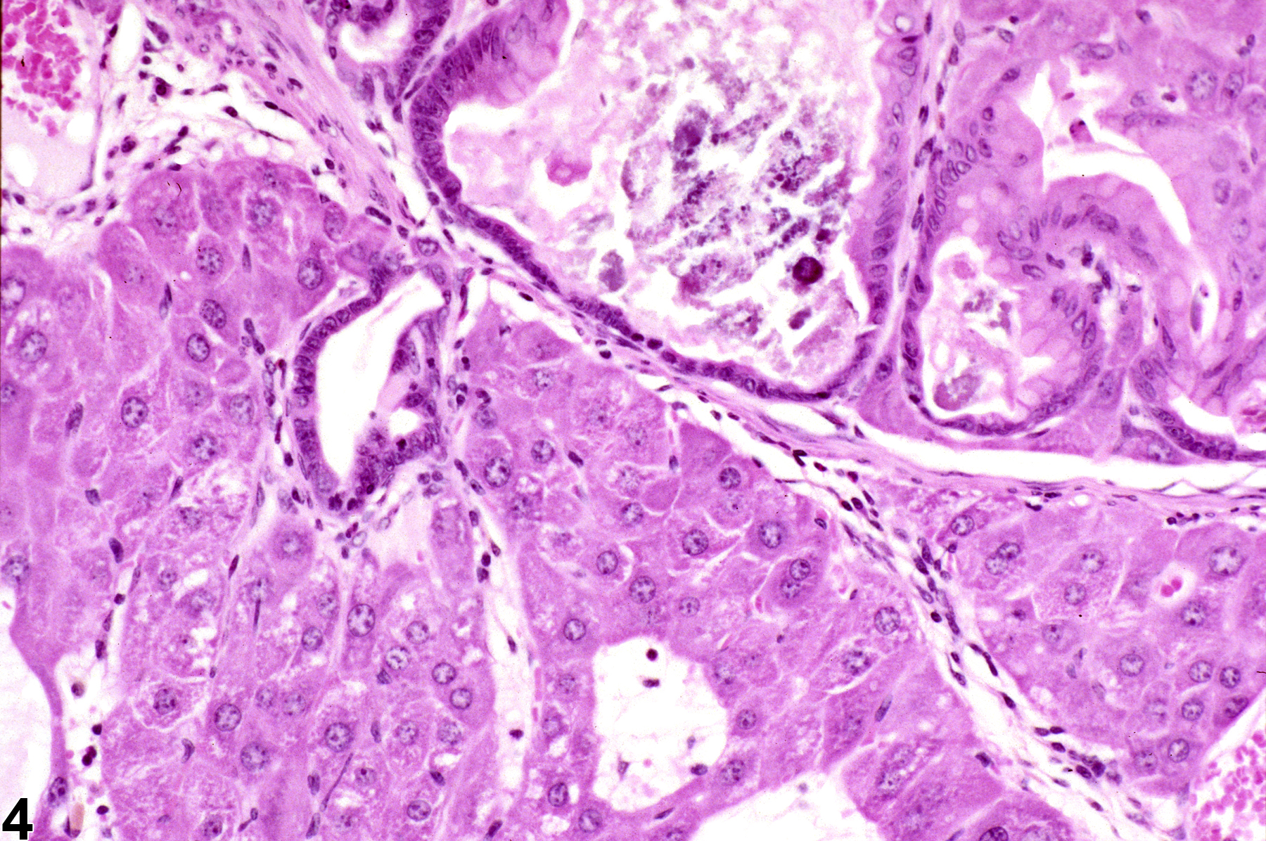 Image of ectopic tissue (liver) in the glandular stomach from a female B6C3F1 mouse in a chronic study
