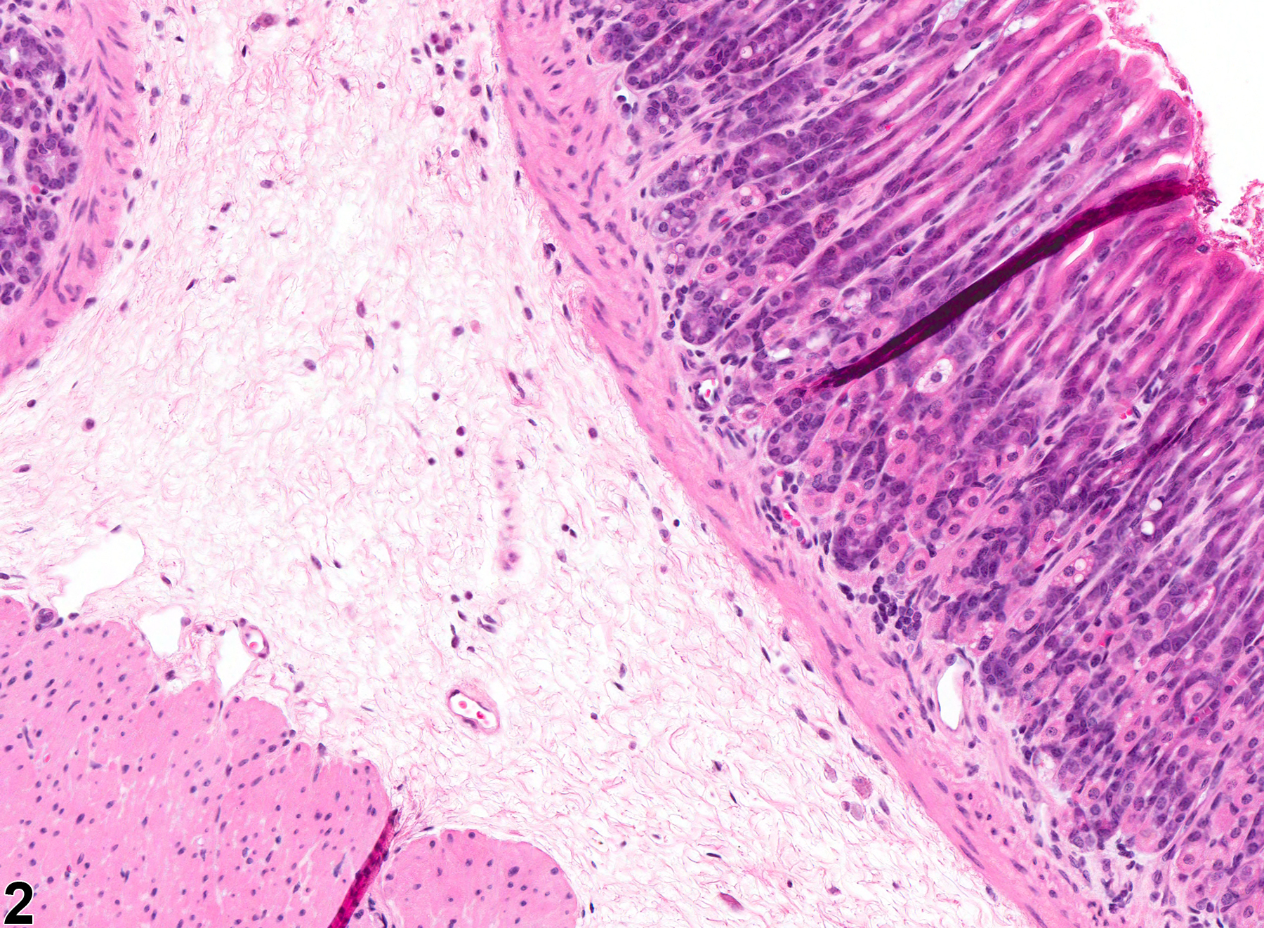 Image of edema in the glandular stomach from a female B6C3F1 mouse in a chronic study