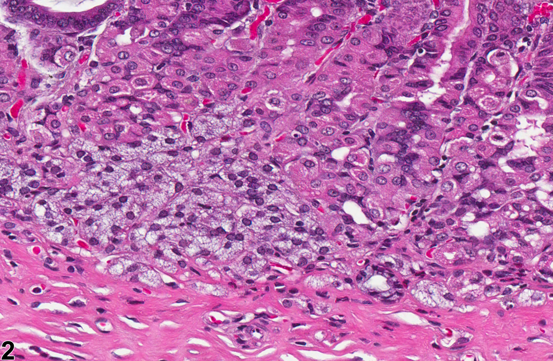Image of hyperplasia in the glandular stomach epithelium from a female F344/N rat in a chronic study