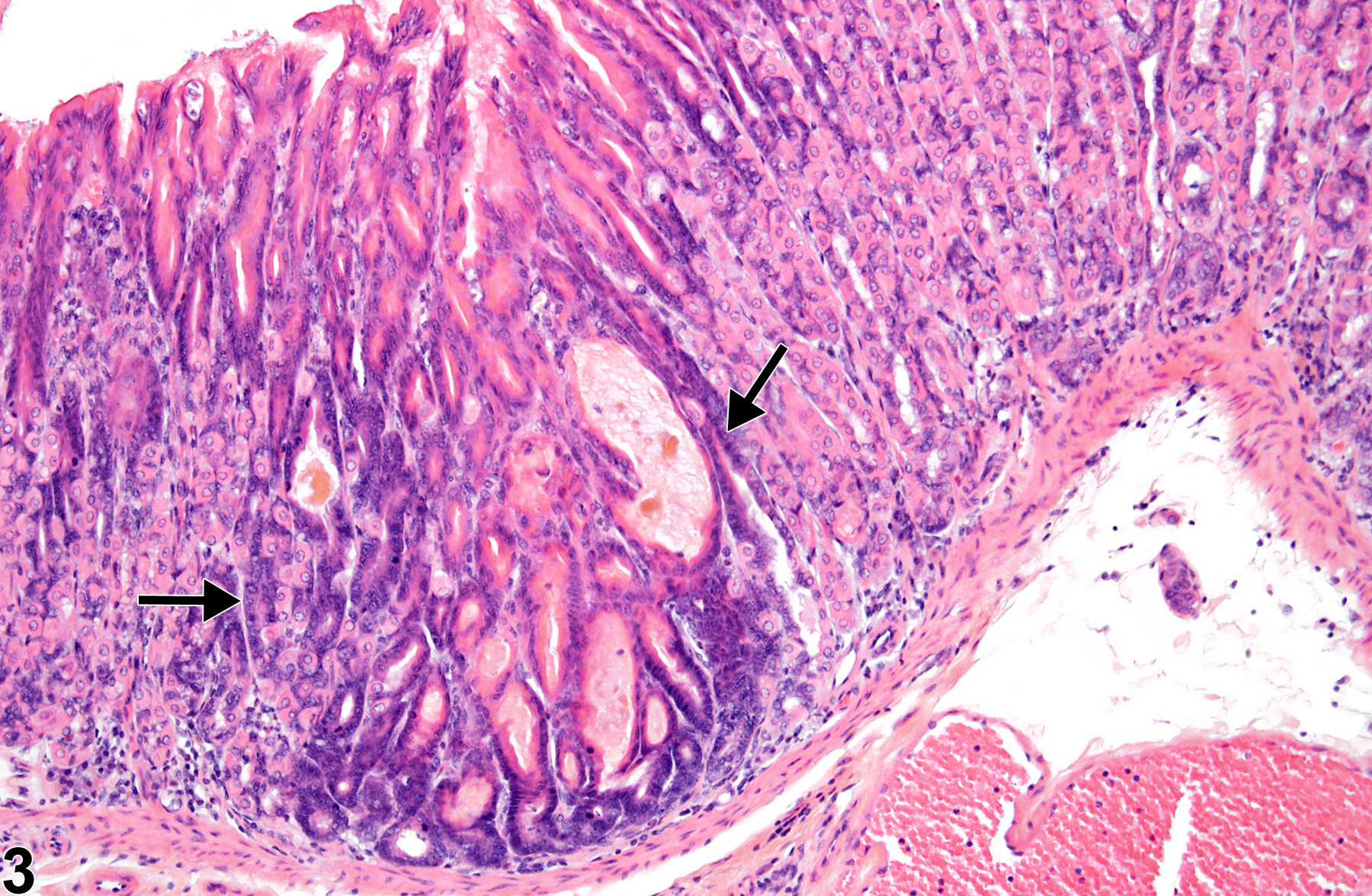 Image of hyperplasia in the glandular stomach epithelium from a male B6C3F1 mouse in a chronic study
