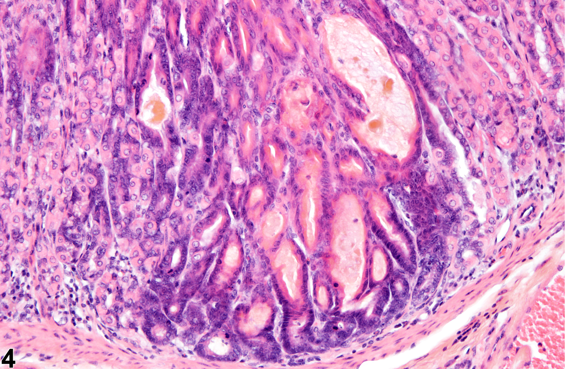 Image of hyperplasia in the glandular stomach epithelium from a male B6C3F1 mouse in a chronic study
