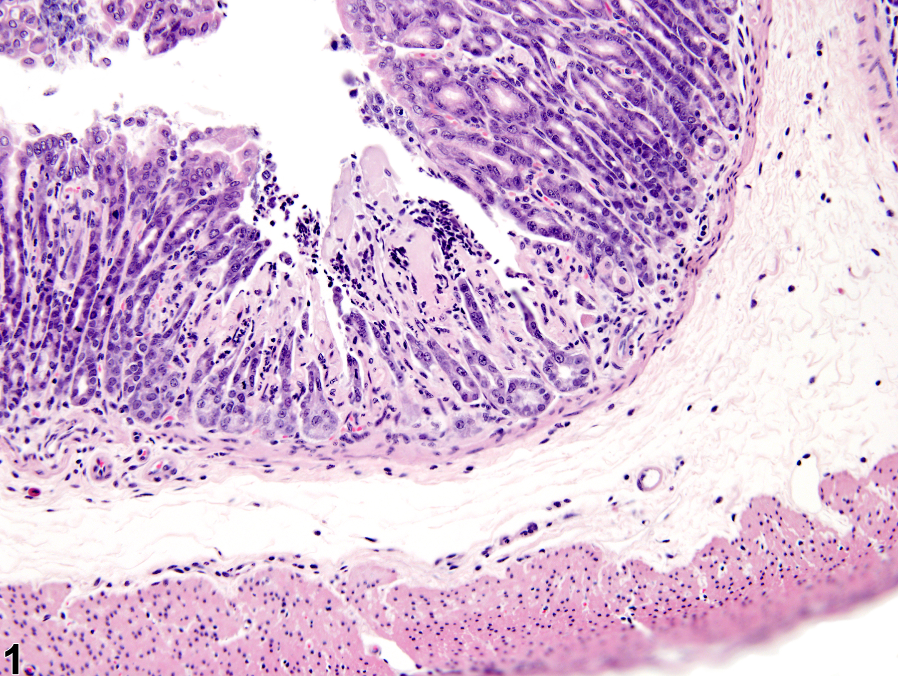 Image of erosion in the glandular stomach from a male B6C3F1 mouse in a subchronic study