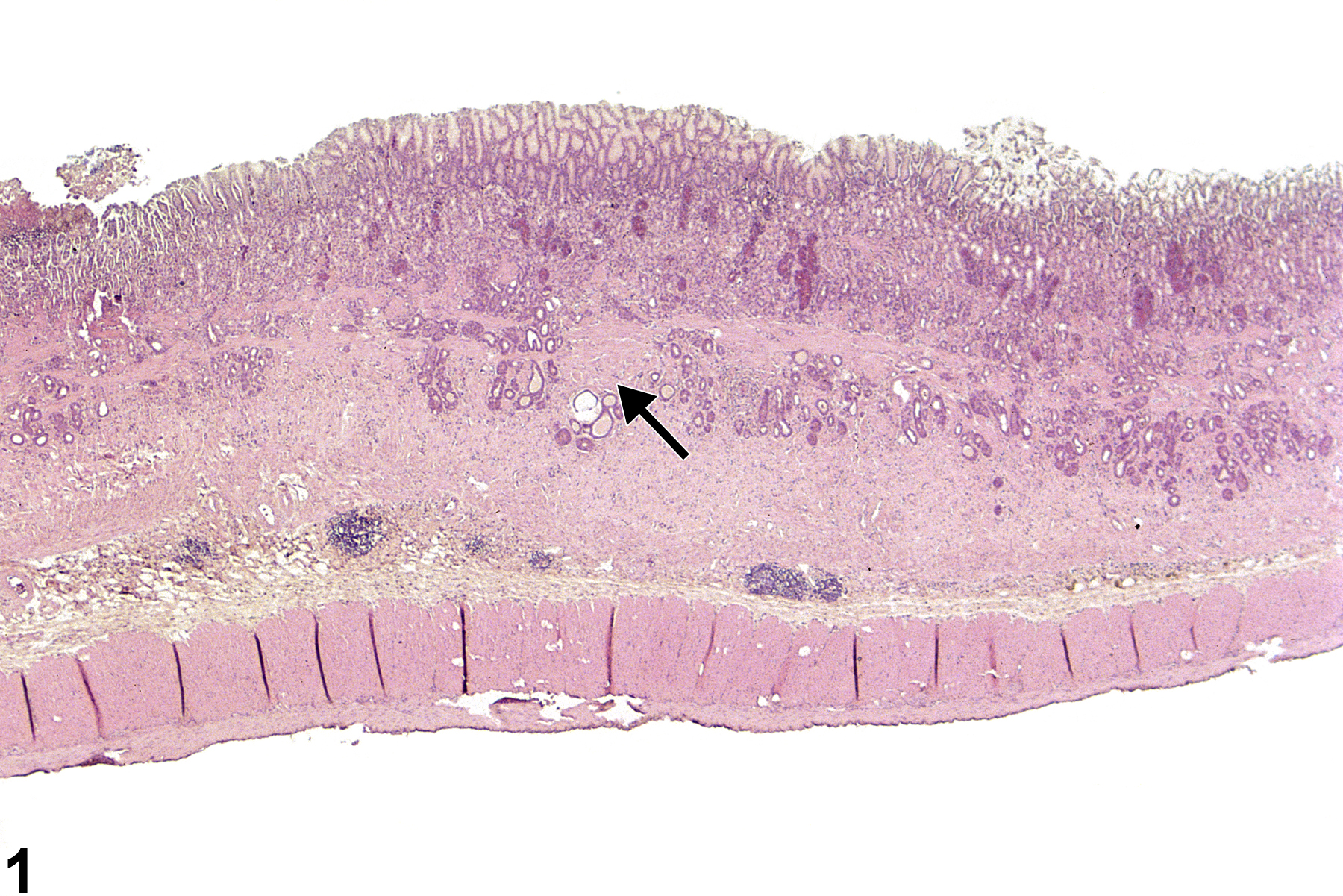 Image of fibrosis in the glandular stomach from a male F344/N rat in a chronic study
