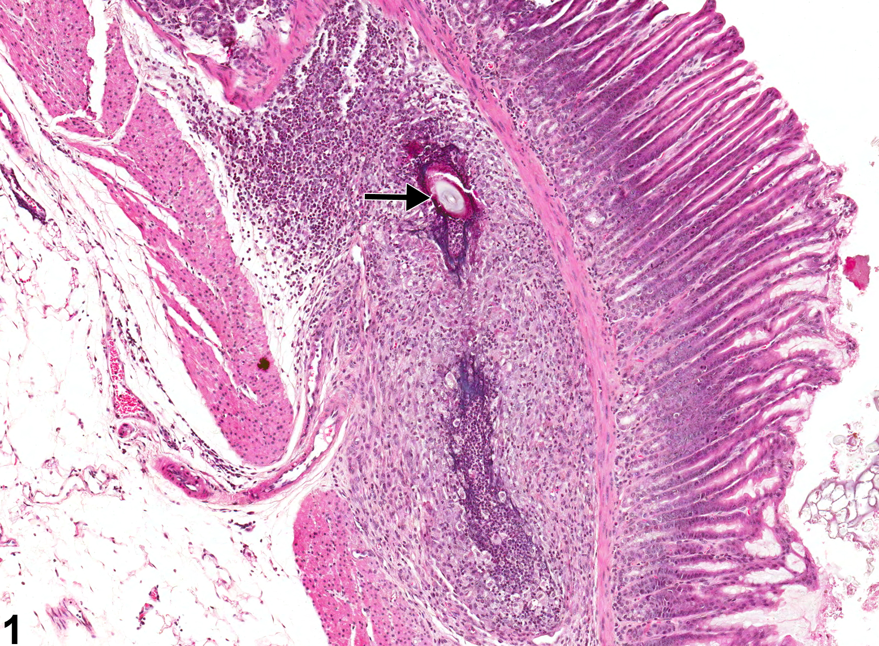 Image of foreign body in the glandular stomach from a male B6C3F1 mouse in a chronic study