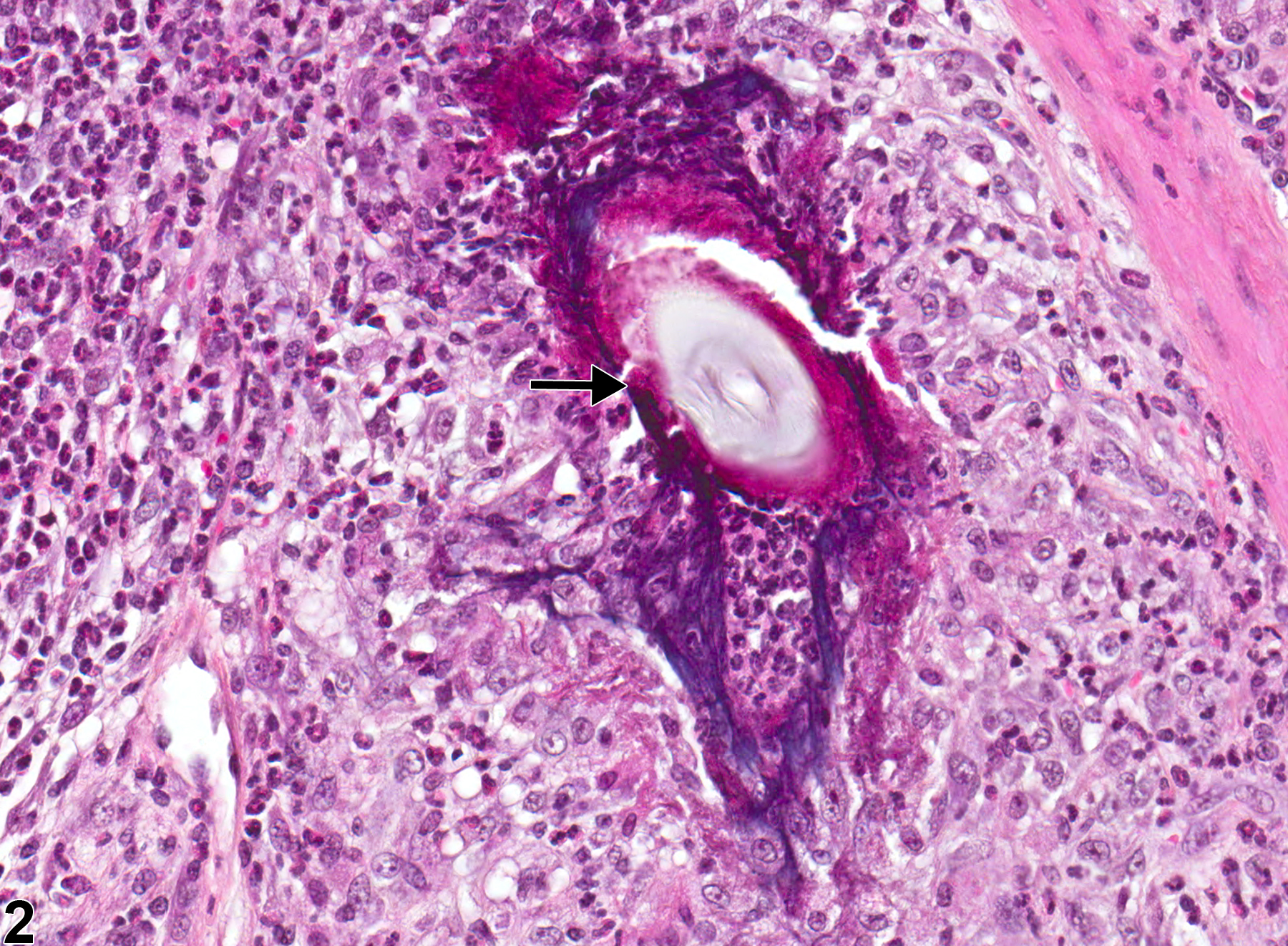 Image of foreign body in the glandular stomach from a male B6C3F1 mouse in a chronic study