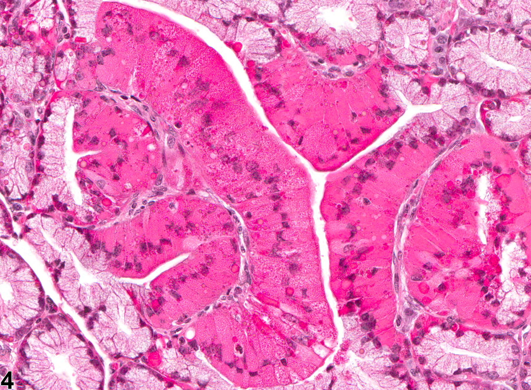 Image of hyaline droplet in the glandular stomach from a female B6C3F1 mouse in a chronic study