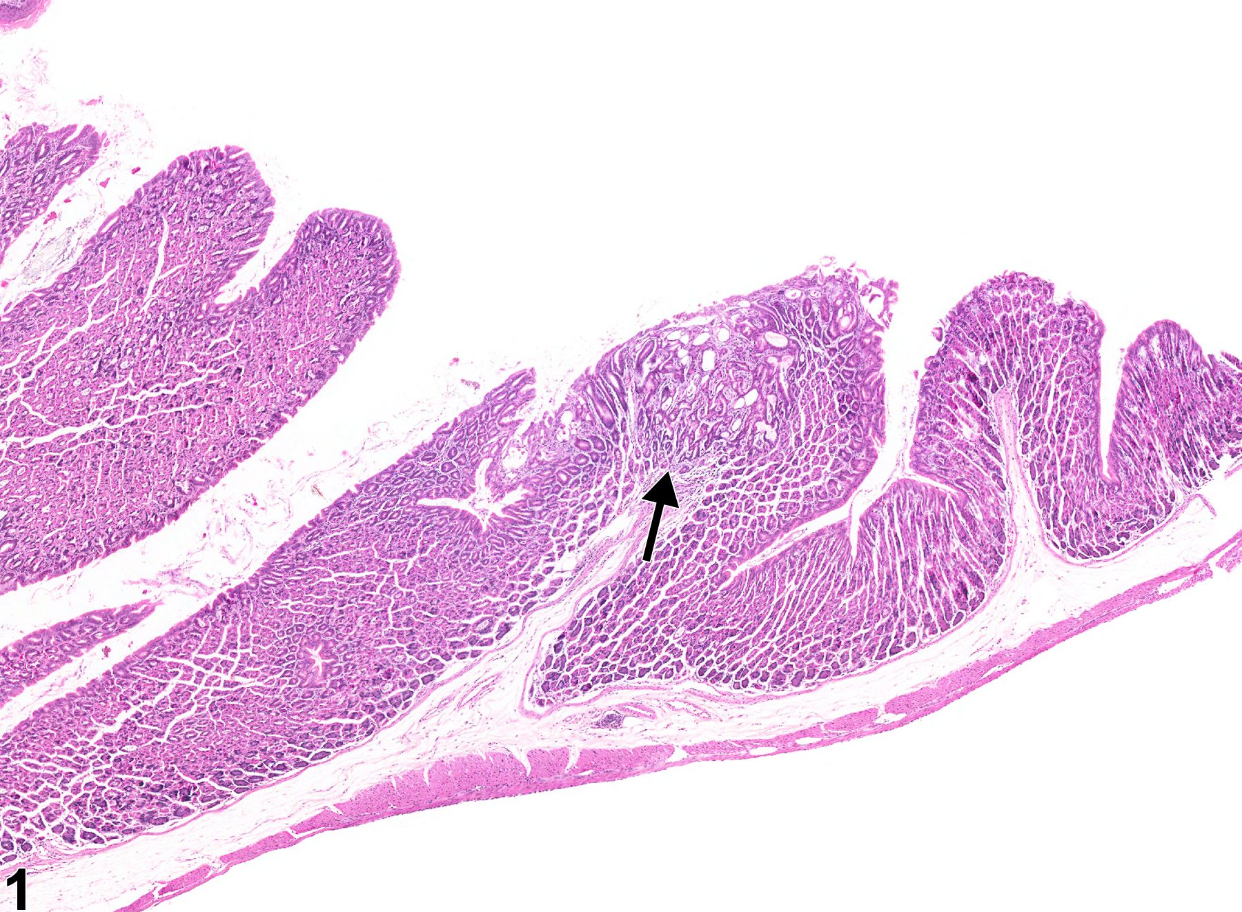 Image of hyperplasia, atypical in the glandular stomach epithelium from a female B6C3F1 mouse in a chronic study