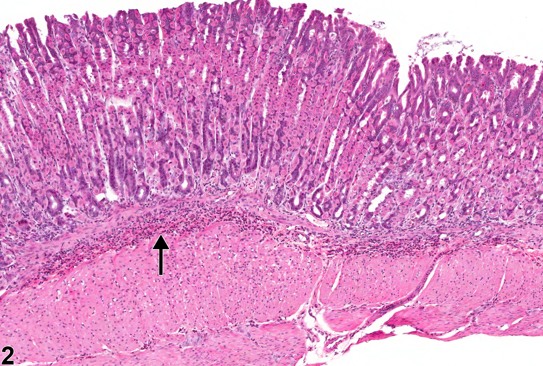 Image of infiltration cellular  in the glandular stomach from a female B6C3F1 mouse in a subchronic study