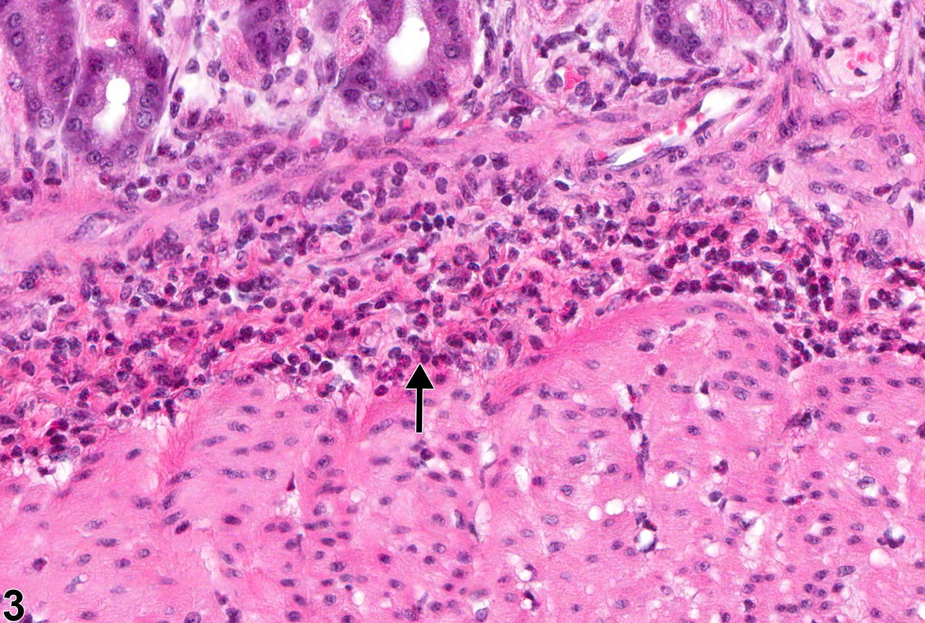 Image of infiltration cellular  in the glandular stomach from a female B6C3F1 mouse in a subchronic study