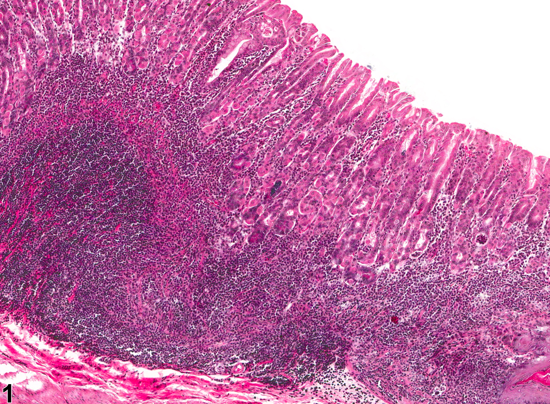 Image of inflammation in the glandular stomach from a male B6C3F1 mouse in a chronic study