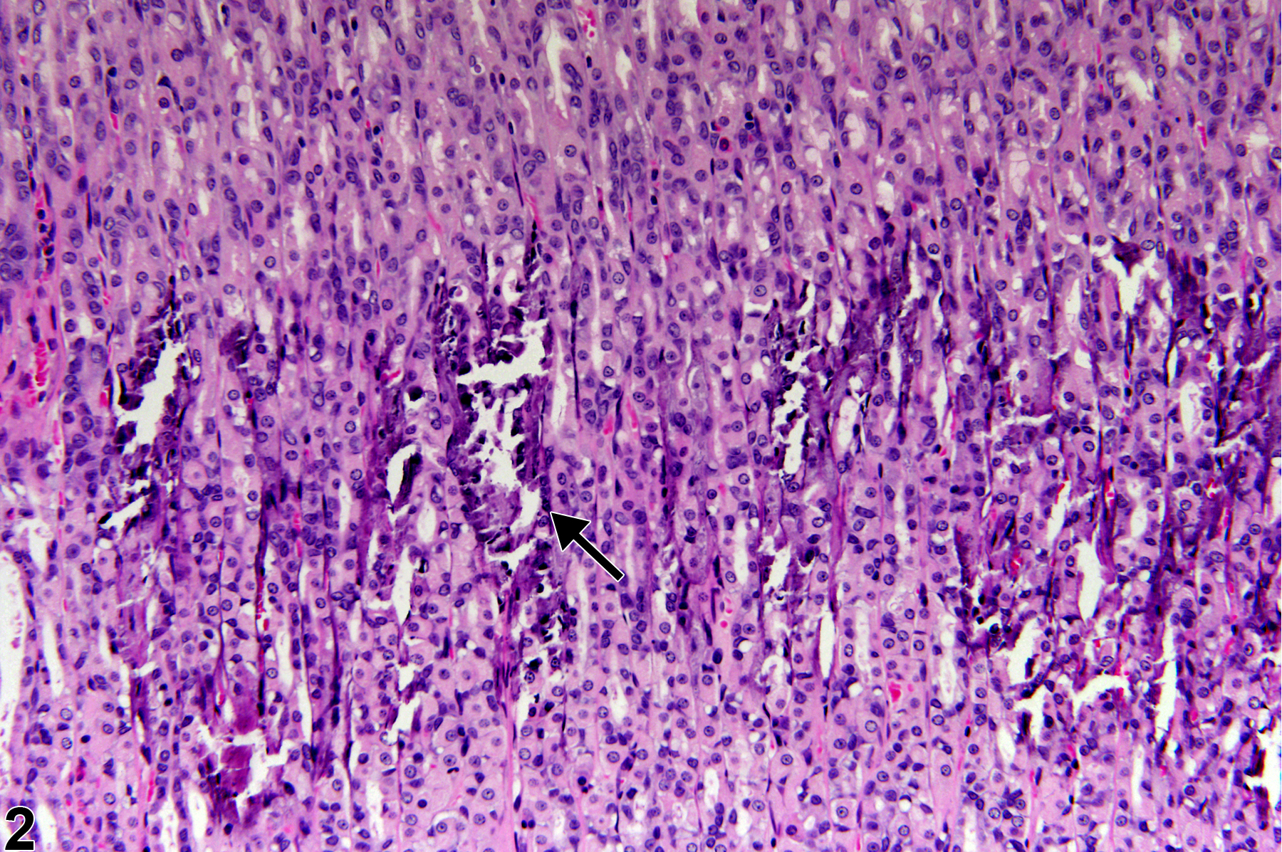 Image of mineralization in the glandular stomach from a male F344/N rat in a chronic study