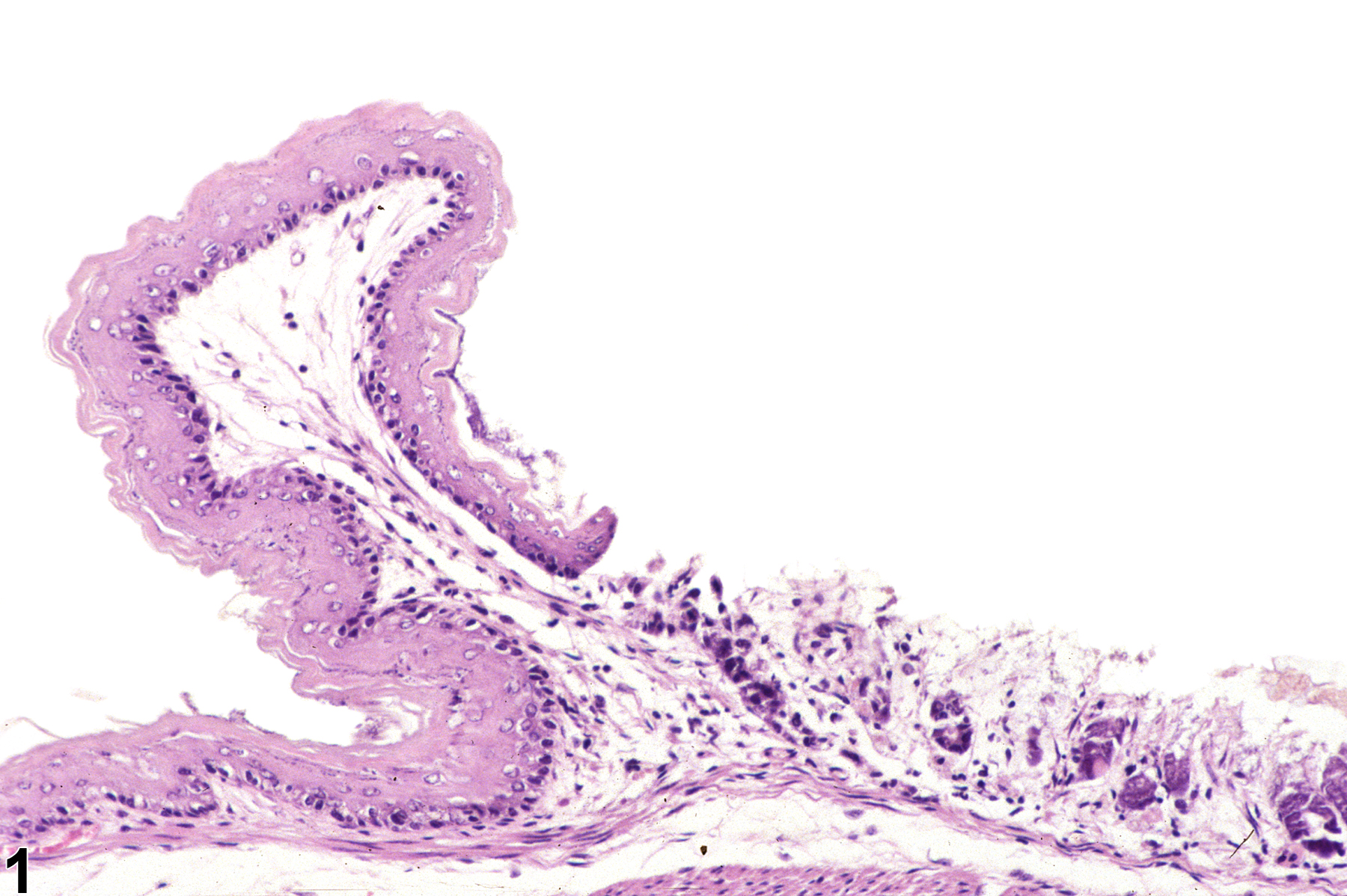 Image of necrosis in the glandular stomach from a female B6C3F1 mouse in a subchronic study