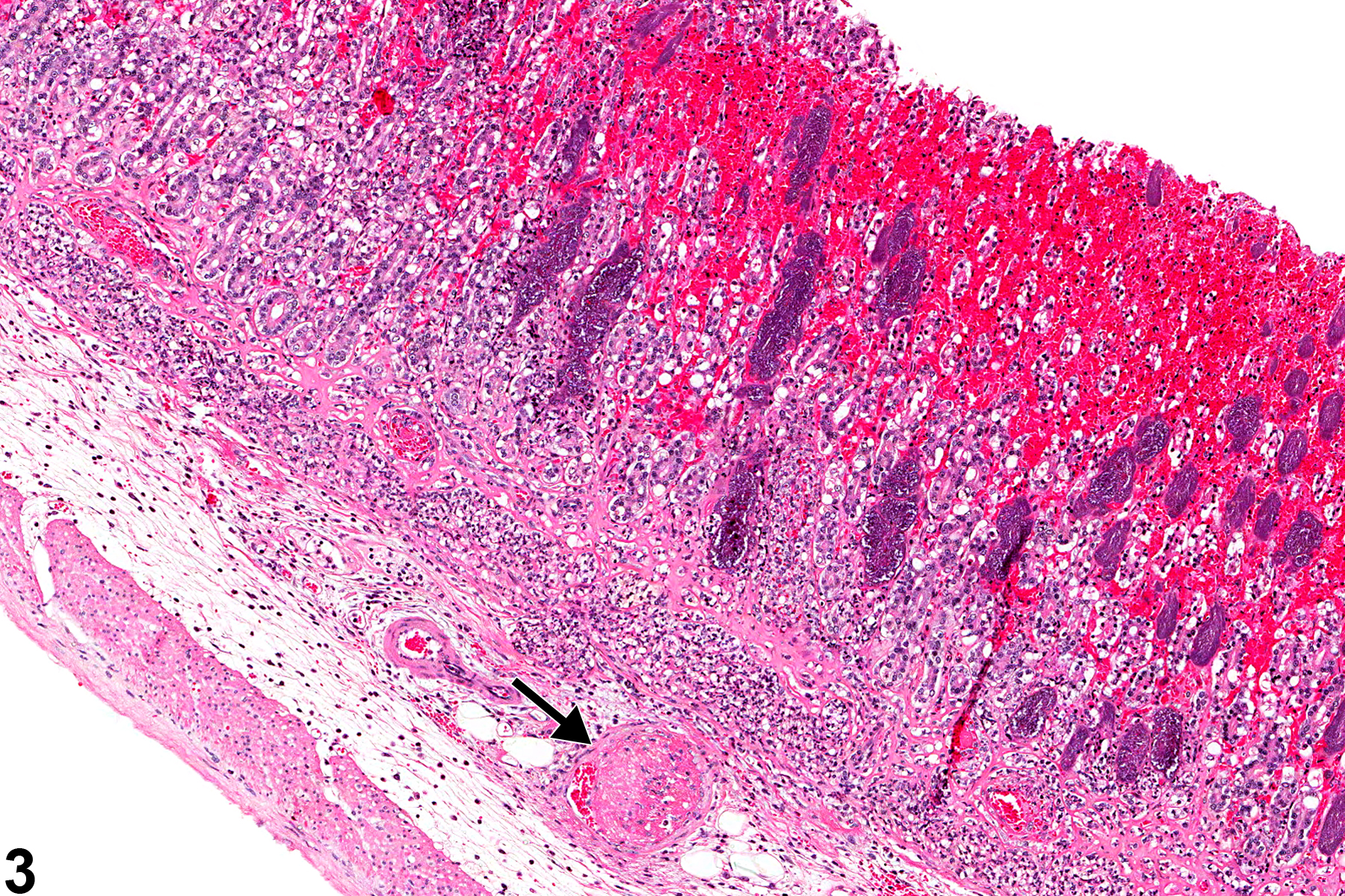 Image of necrosis in the glandular stomach from a male F344/N rat in a chronic study