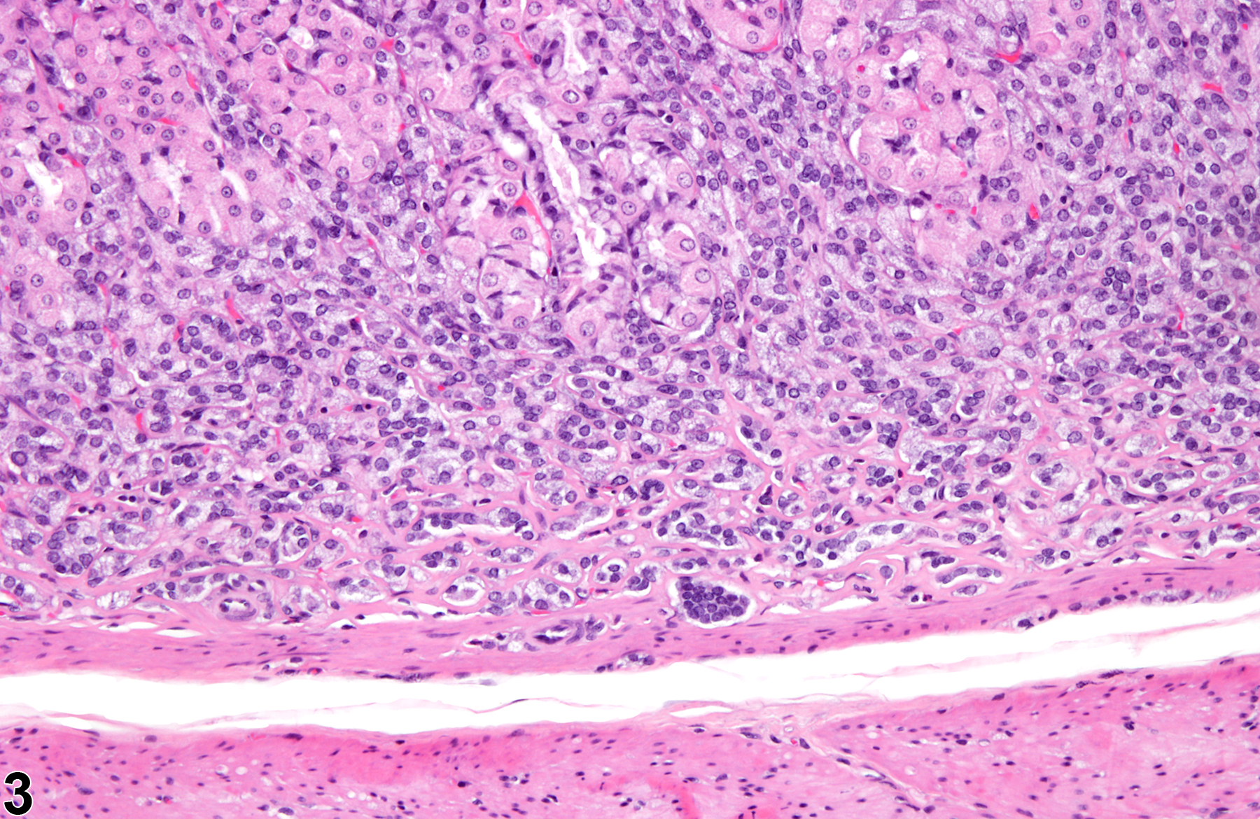 Image of hyperplasia in the glandular stomach neuroendocrine cell from a female F344/N rat in a chronic study