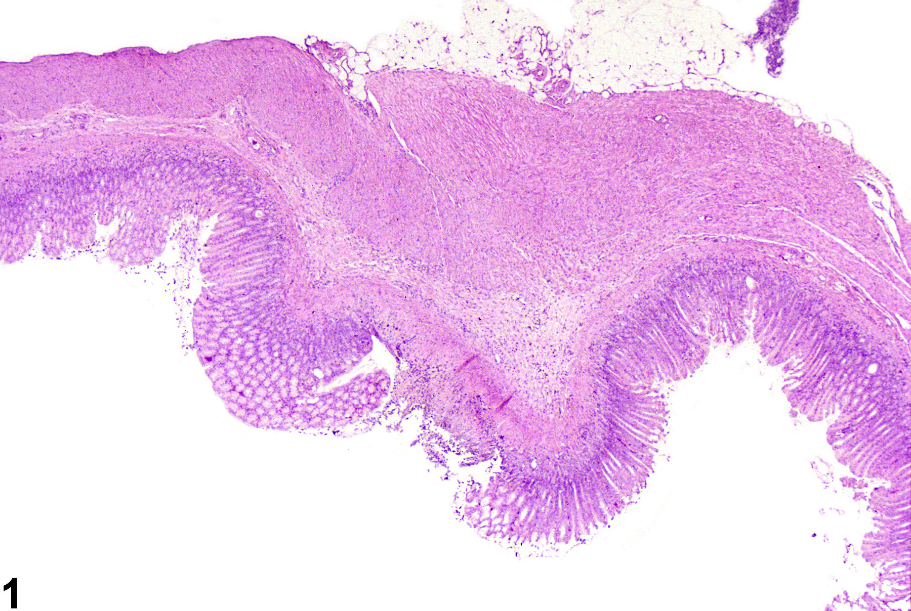 Image of ulcer in the glandular stomach from a male F344/N rat in a chronic study