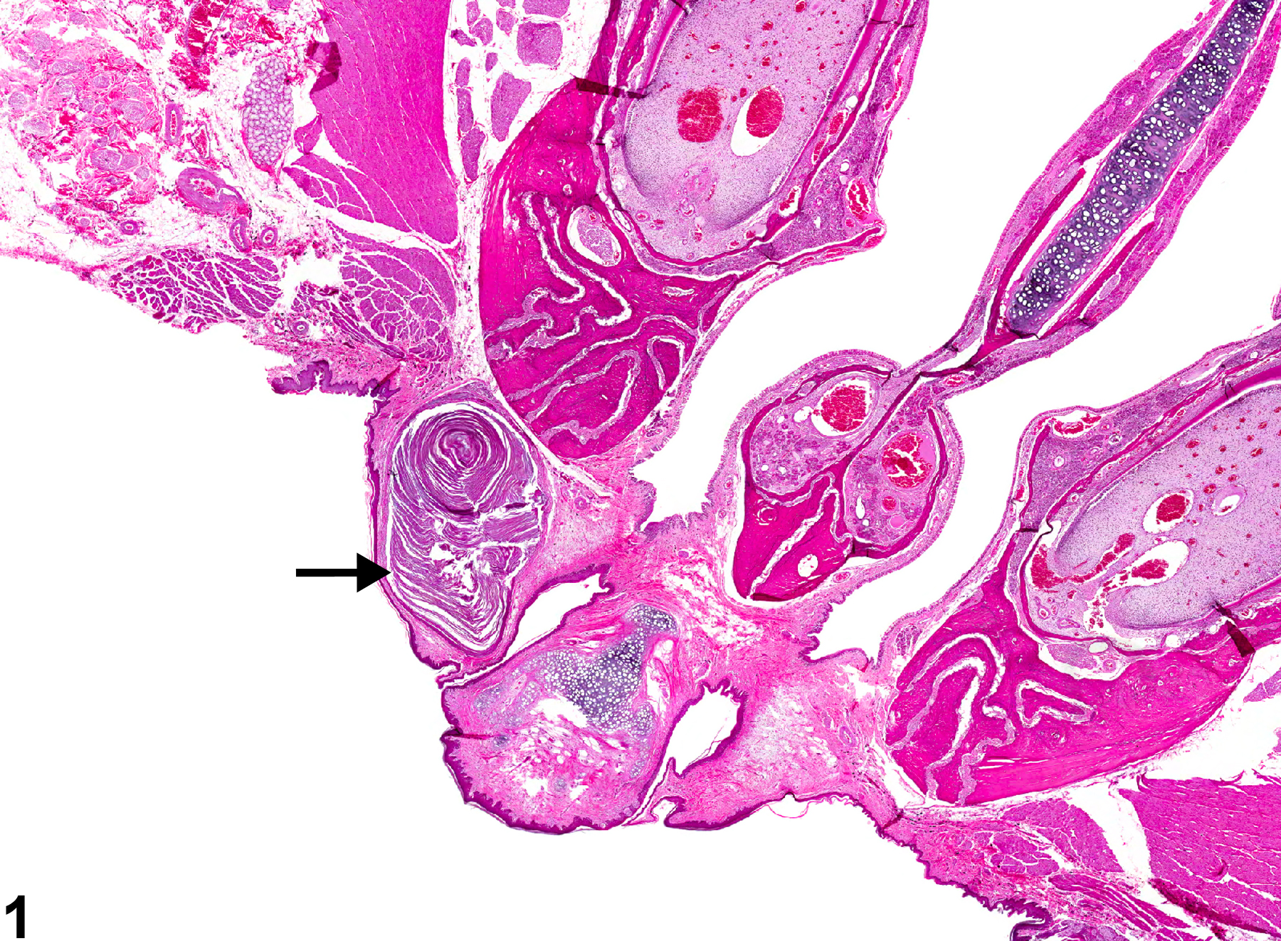 Image of cyst, squamous in the oral mucosa from a female F344/N rat in a chronic study
