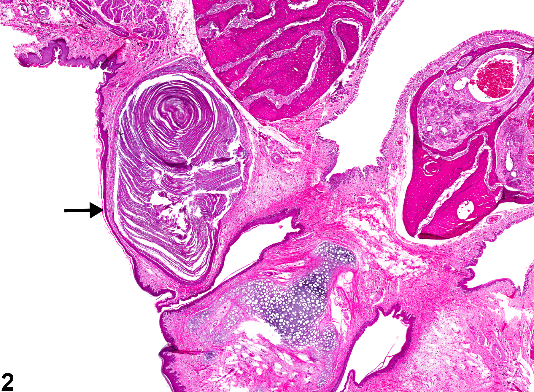 Image of cyst, squamous in the oral mucosa from a female F344/N rat in a chronic study