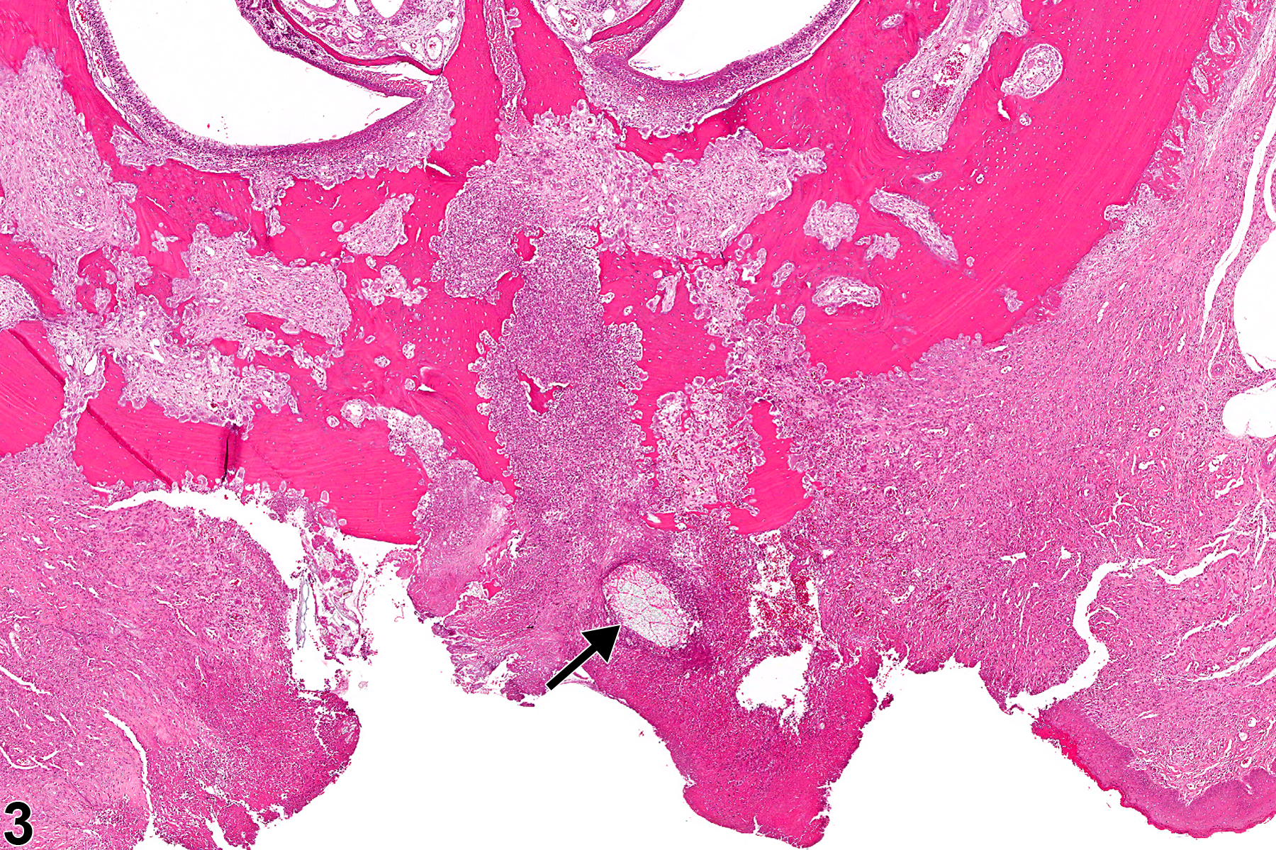 Image of foreign body in the oral mucosa from a male F344/N rat in a chronic study