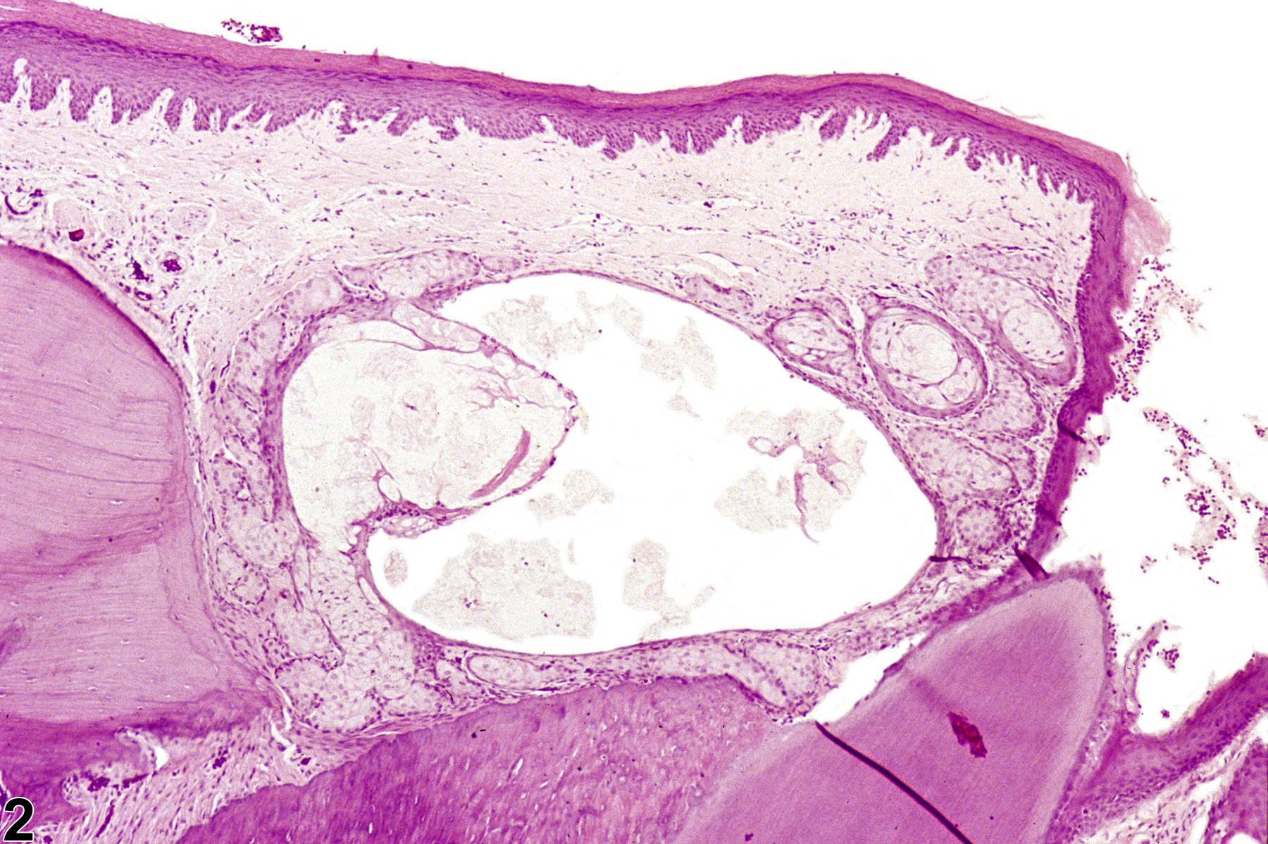 Image of ectopic tissue in the oral mucosa gingiva from a male F344/N rat in a chronic study