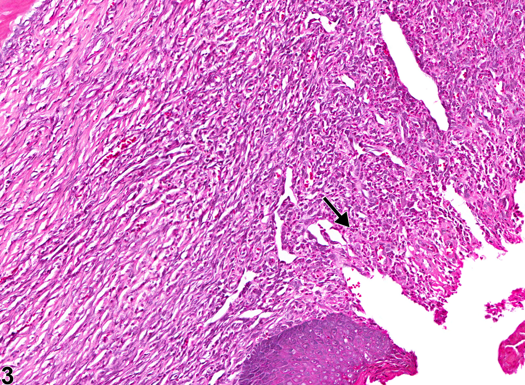 Image of inflammation in the oral mucosa from a male F344/N rat in a chronic study
