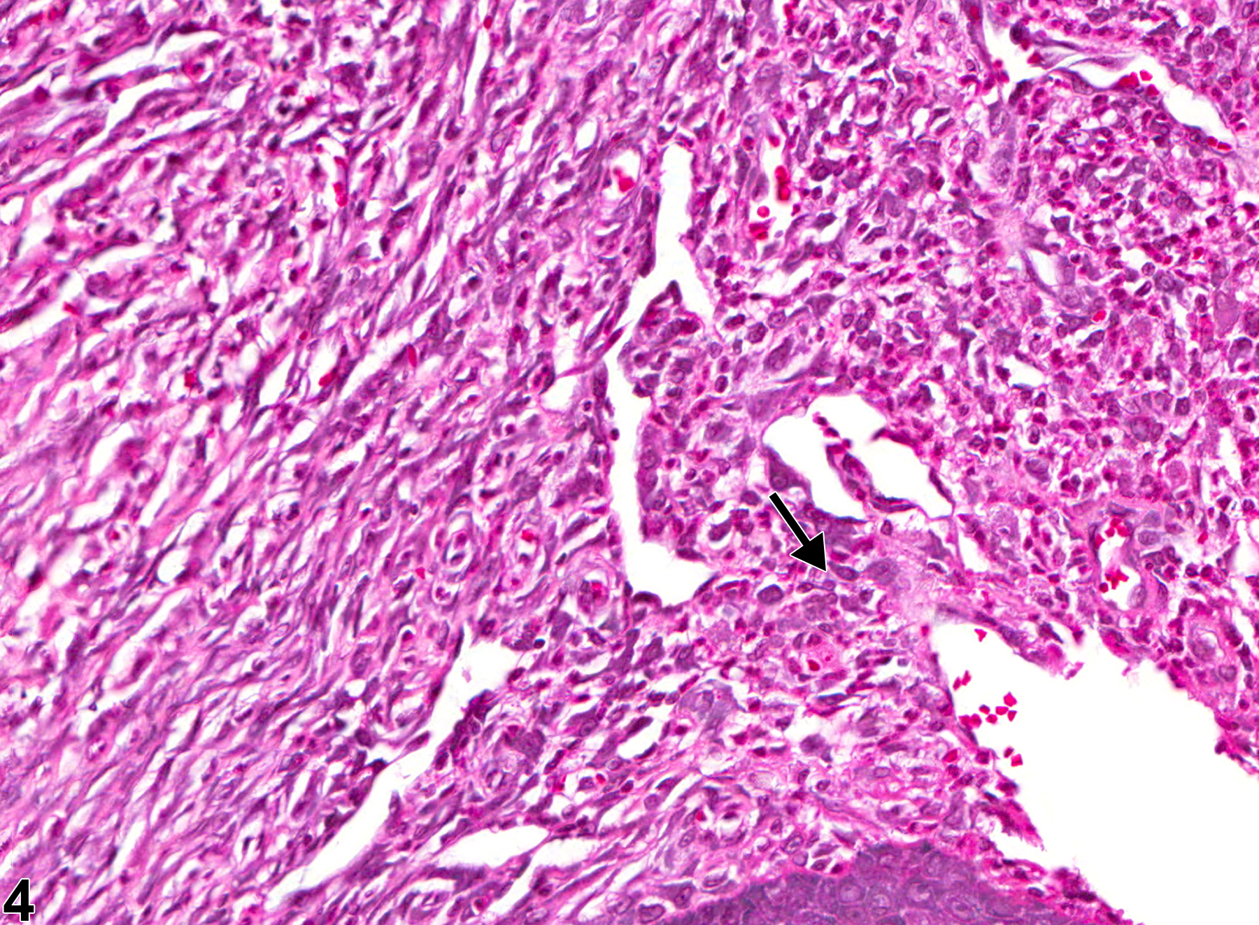 Image of inflammation in the oral mucosa from a male F344/N rat in a chronic study
