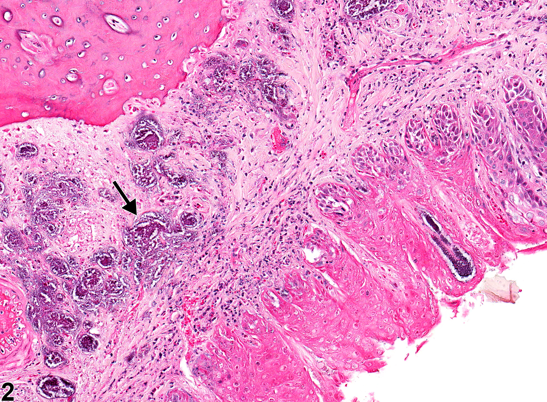 Image of necrosis in the oral mucosa from a male F344/N rat in a subchronic study