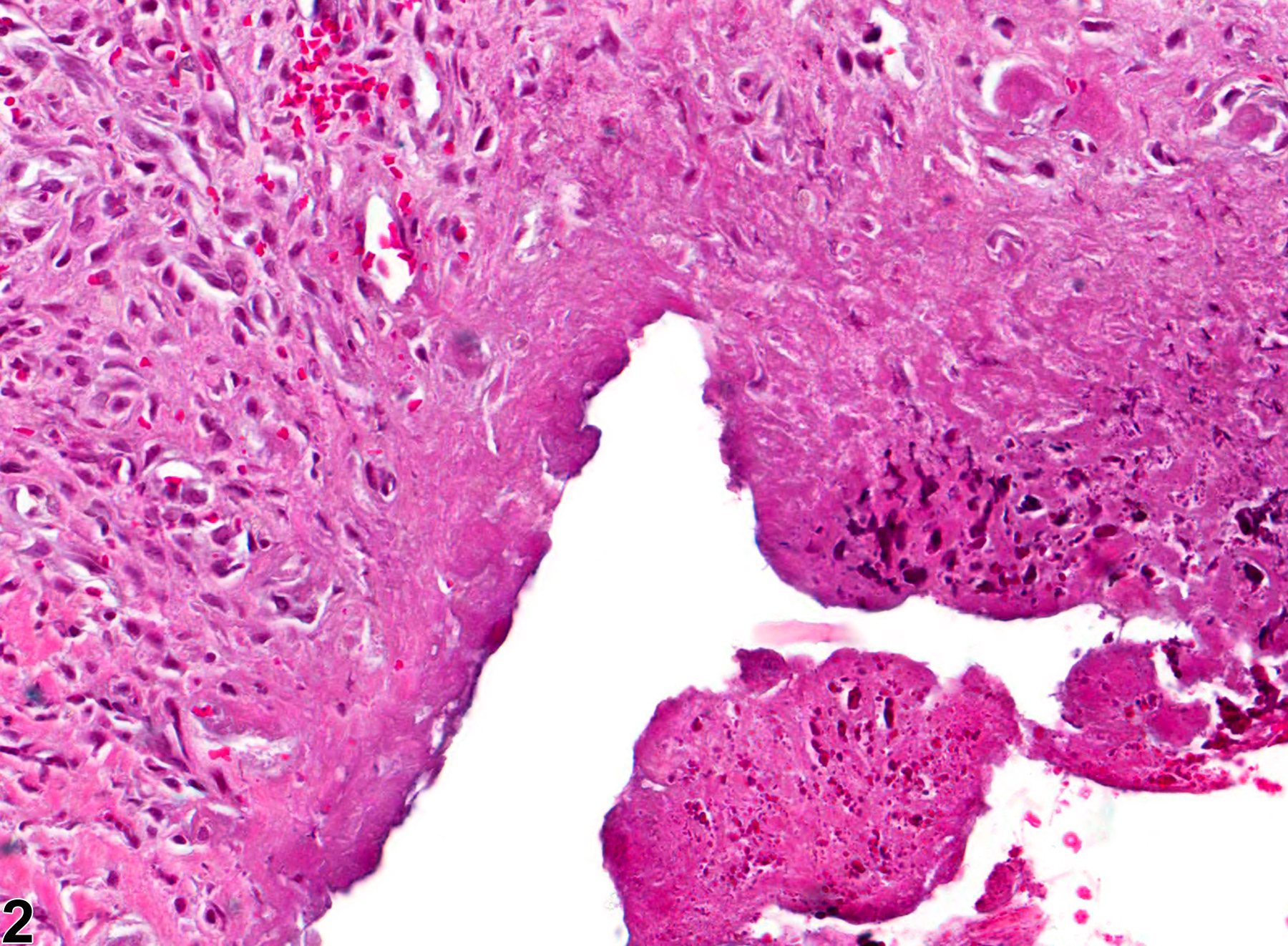 Image of ulcer in the oral mucosa from a female F344/N rat in a chronic study
