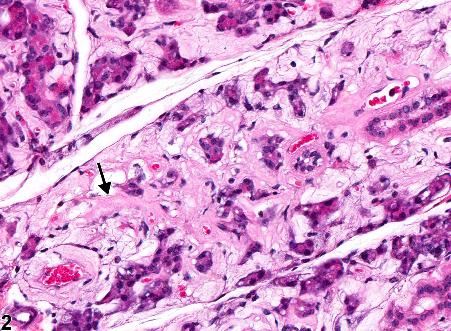 Image of amyloid in the salivary gland from a female Swiss Webster mouse in a chronic study
