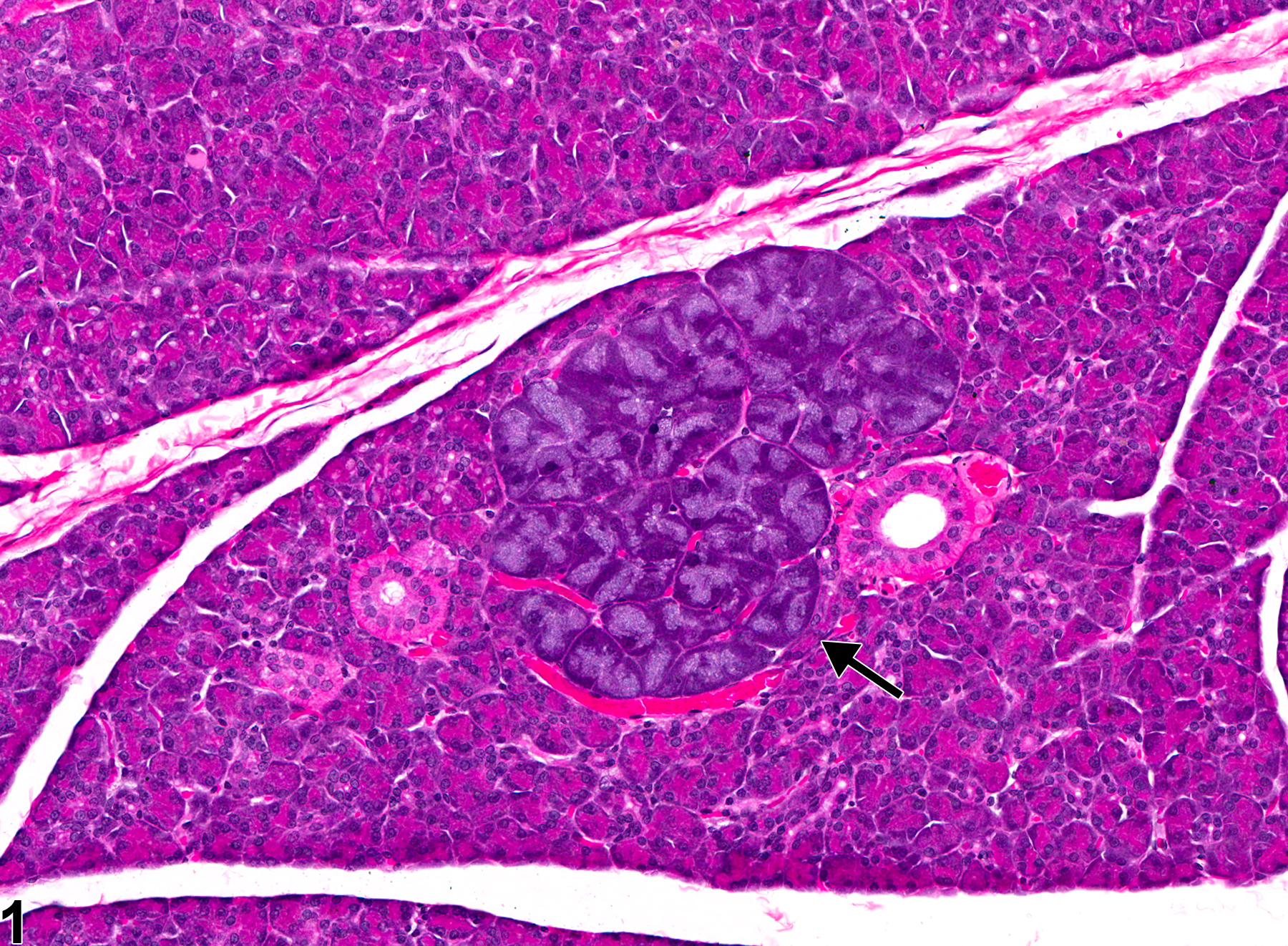 Image of basophilic hypertrophic focus in the parotid salivary gland from a female F344/N rat in a chronic study