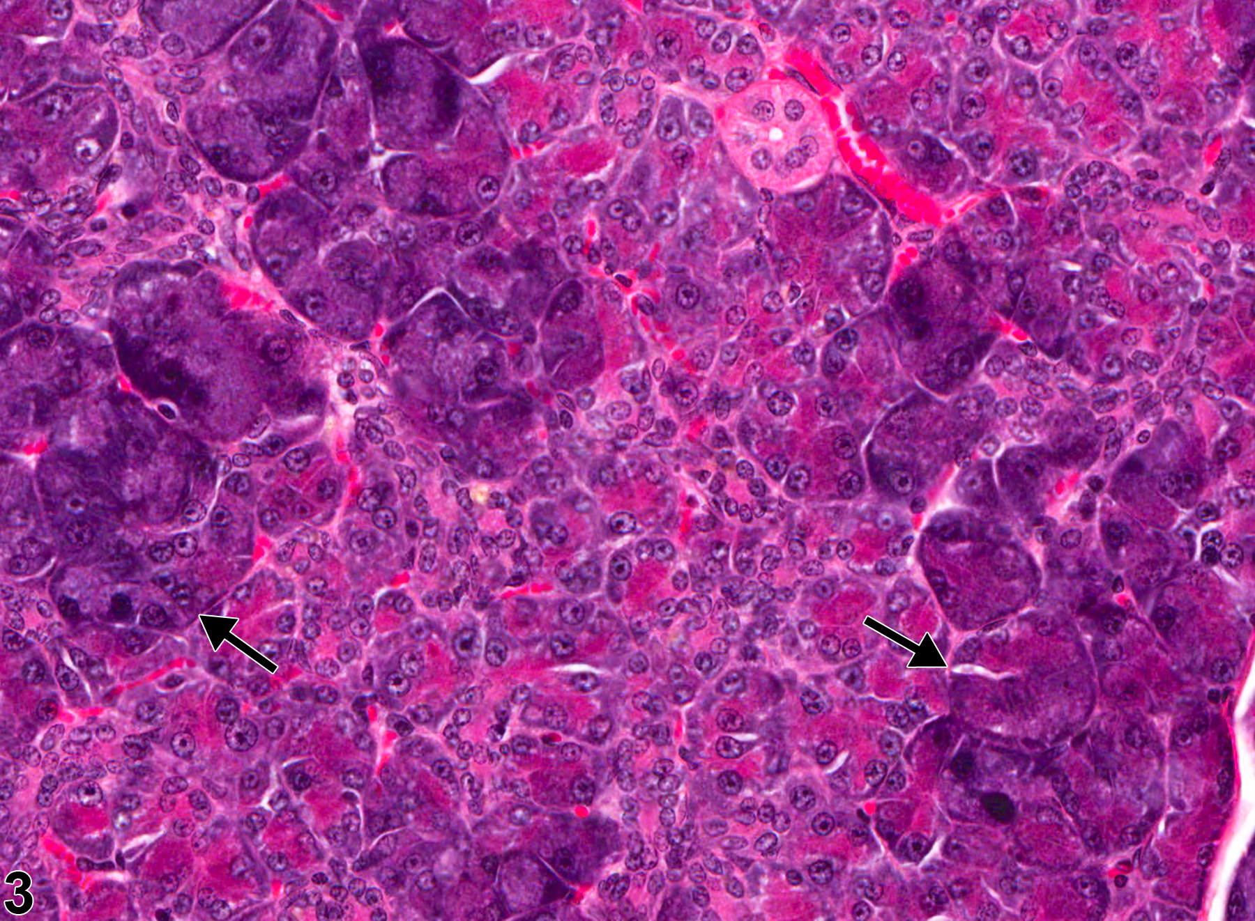 Image of basophilic hypertrophic focus in the parotid salivary gland from a male F344/N rat in a chronic study