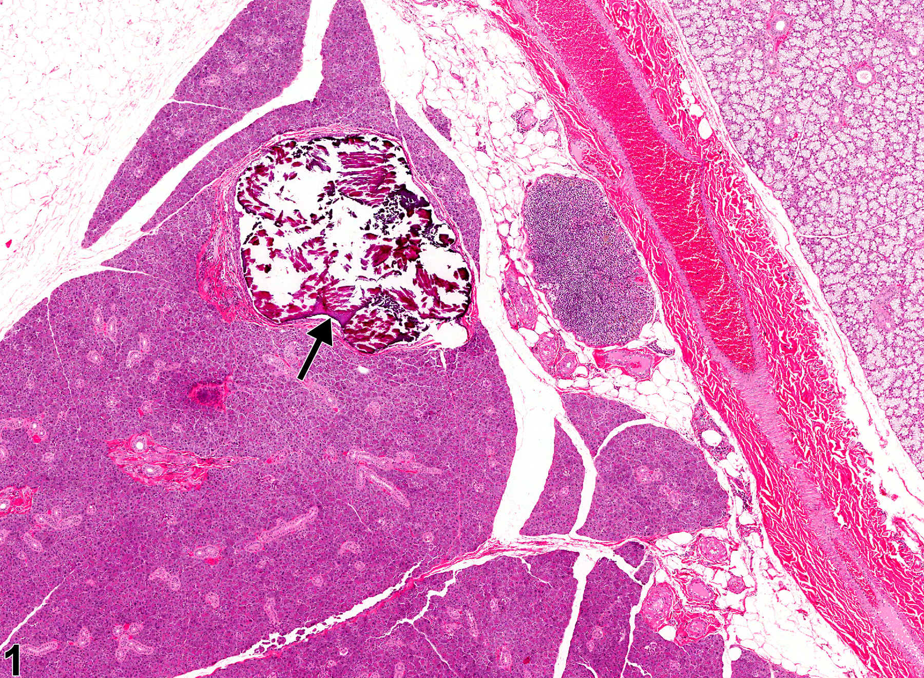 Image of concretion in the salivary gland duct from a female F344/N rat in a subchronic study