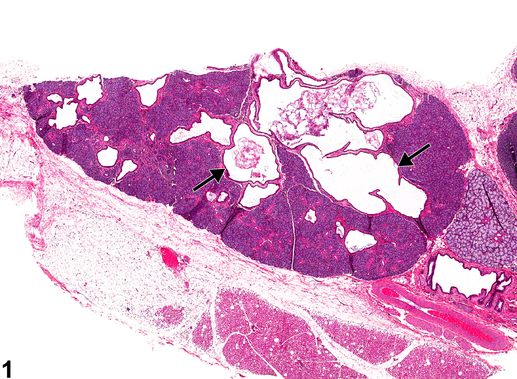 Image of dilation in the salivary gland duct from a female F344/N rat in a chronic study