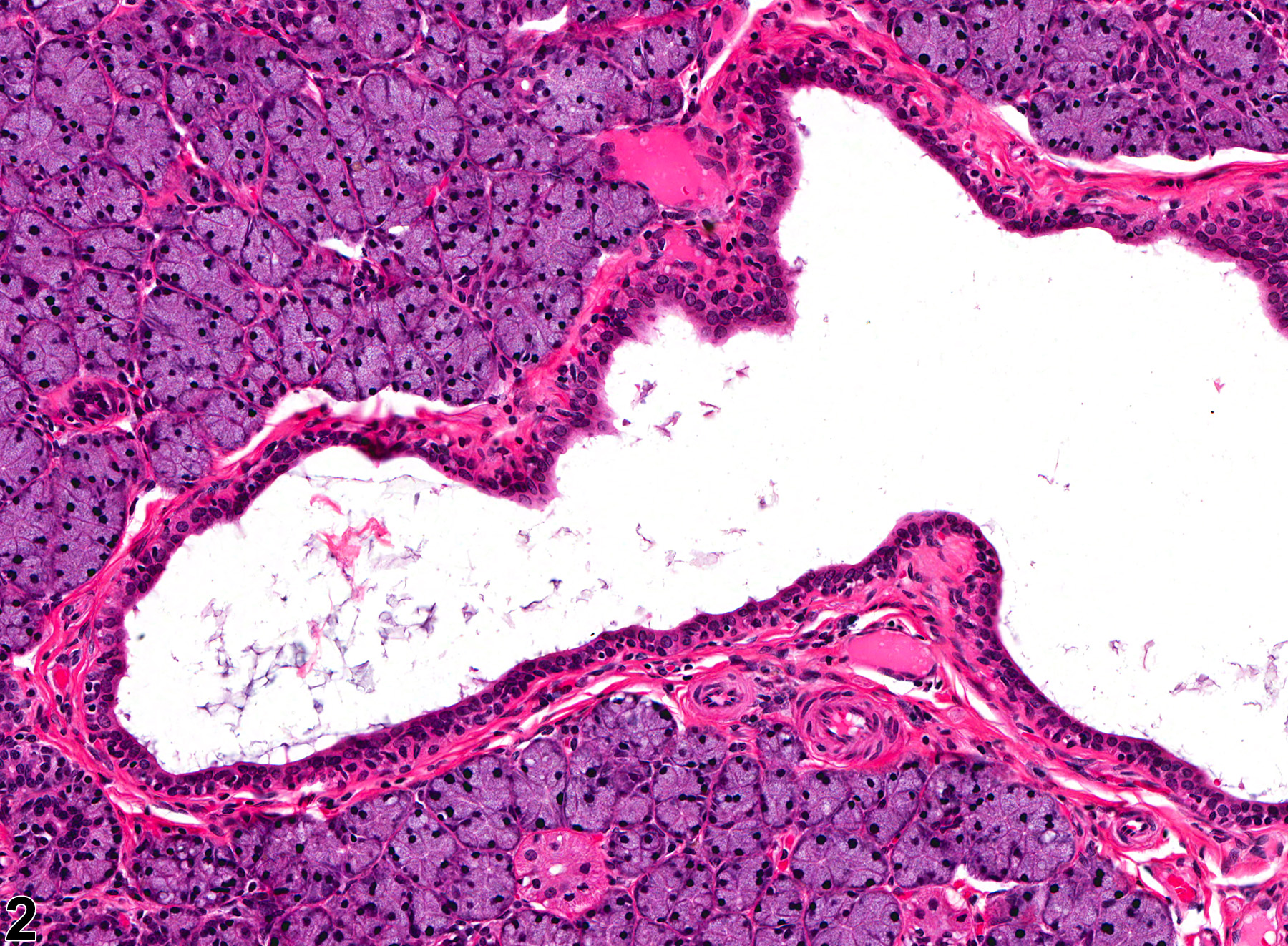 Image of dilation in the salivary gland duct from a female F344/N rat in a chronic study