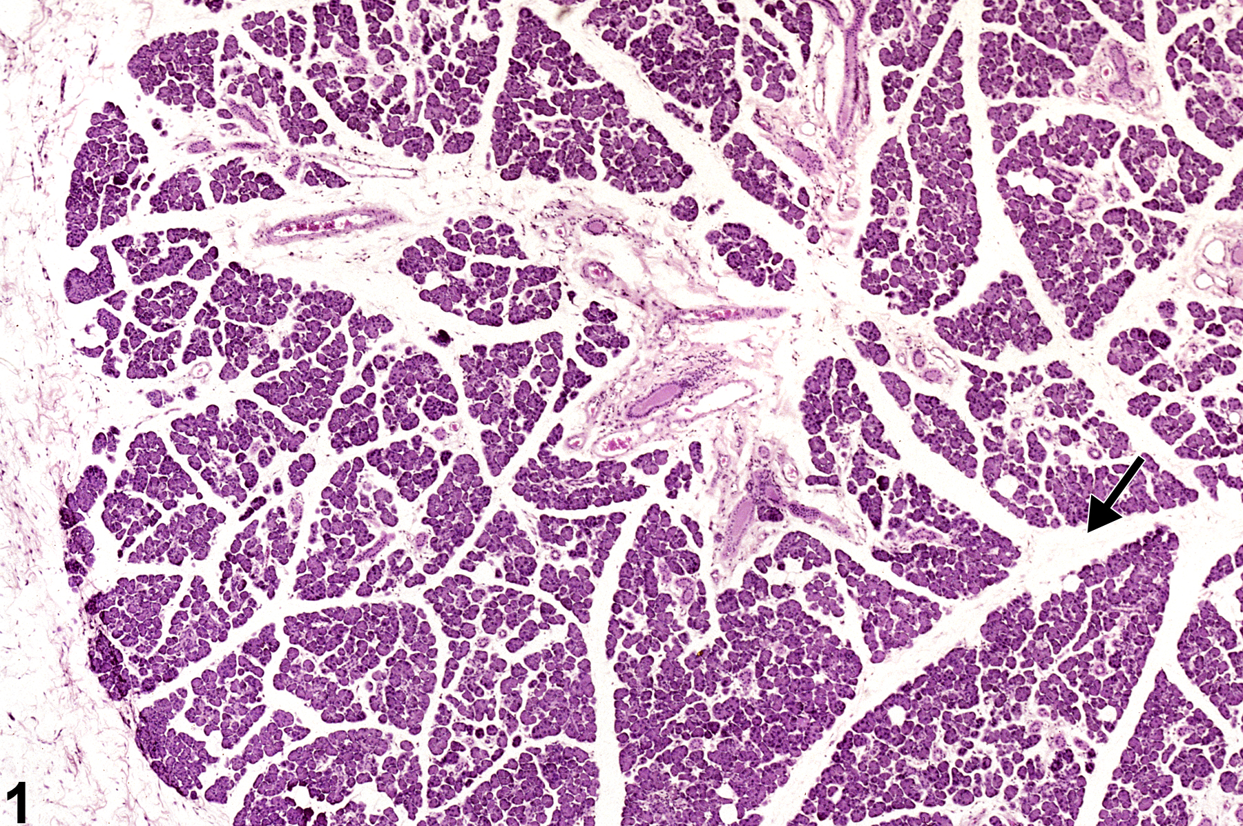 Image of edema in the salivary gland from a male F344/N rat in a chronic study