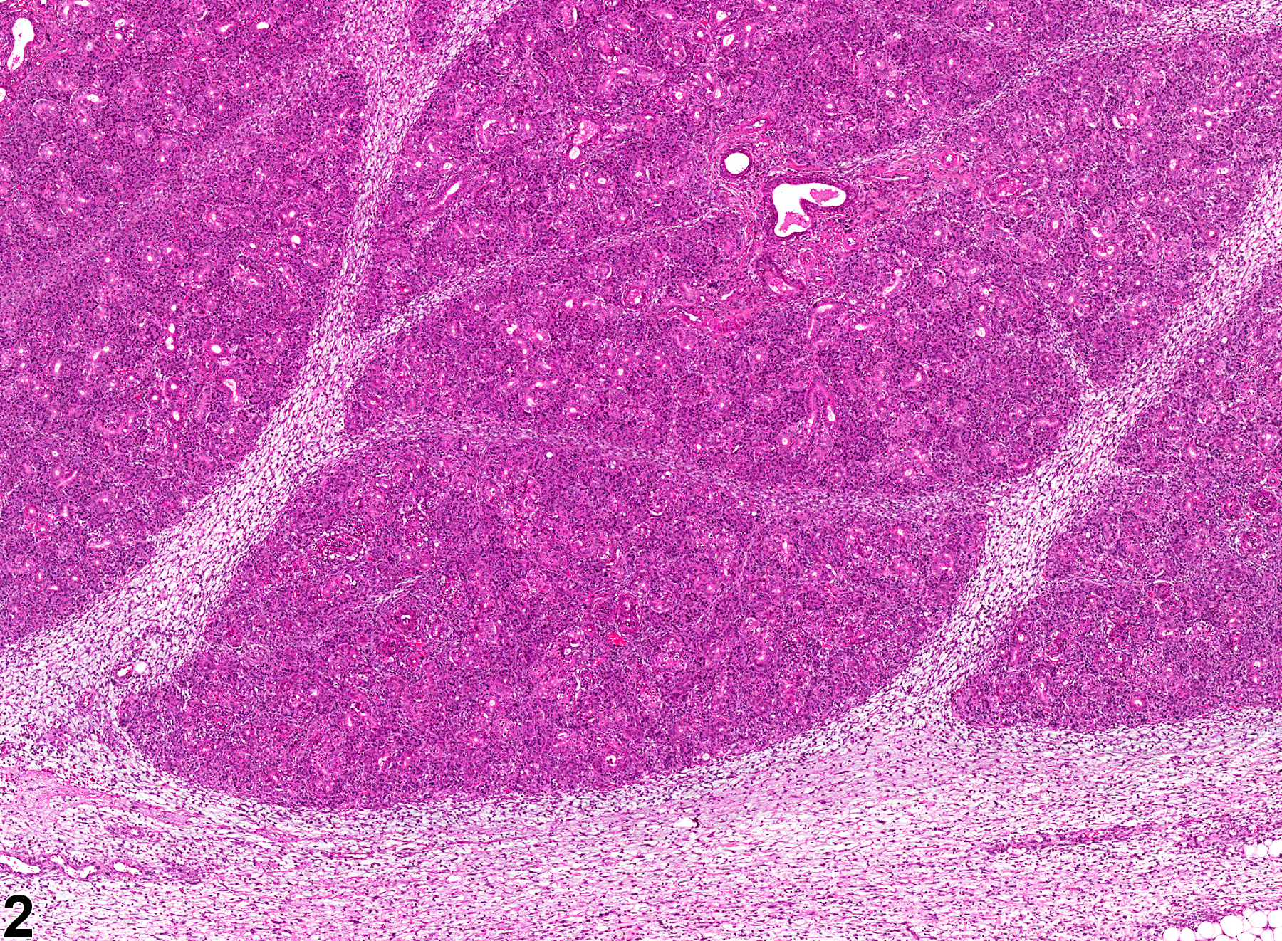 Image of fibrosis in the salivary gland from a male F344/N rat in a subchronic study
