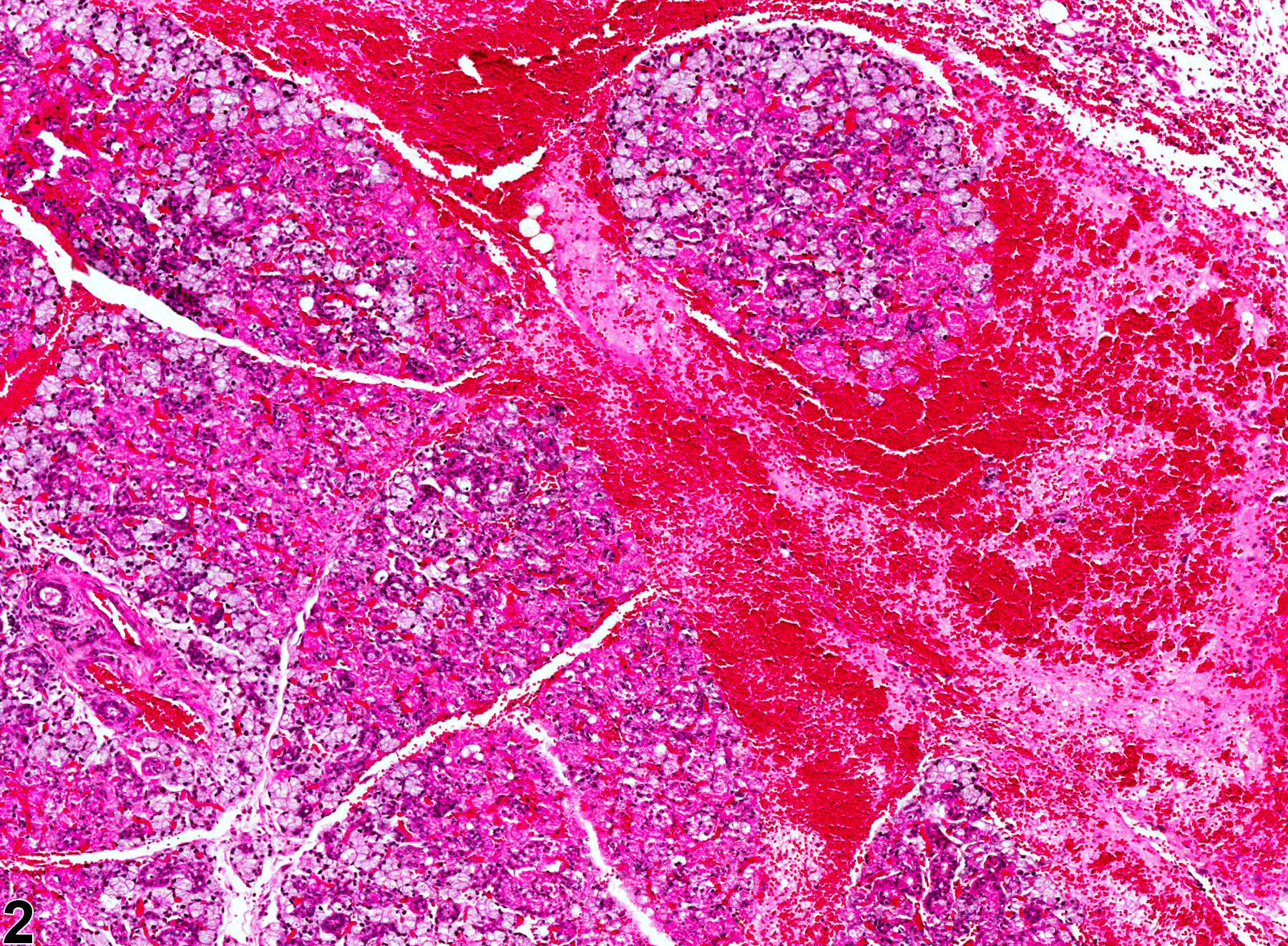 Image of hemorrhage in the salivary gland from a female B6C3F1 mouse in a chronic study