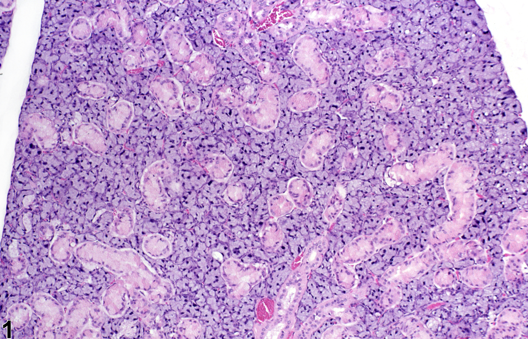 Image of normal comparison to hyperplasia in the salivary gland from a male F344/N rat in a subchronic study