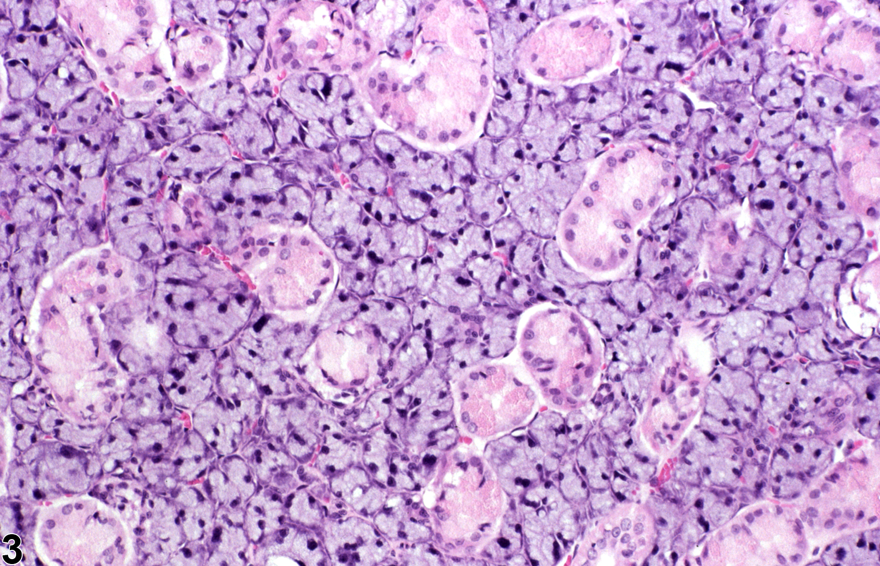 Image of normal comparison to hyperplasia in the salivary gland from a male F344/N rat in a subchronic study