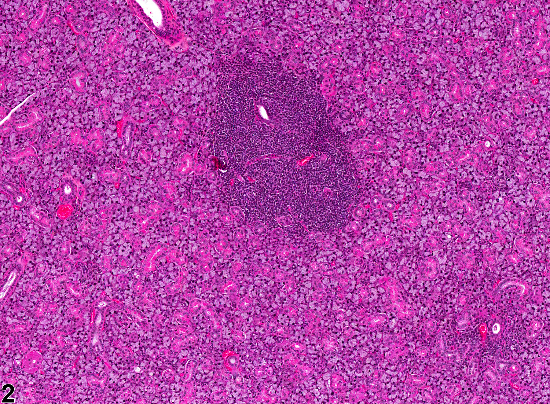 Image of infiltration cellular  in the salivary gland from a female B6C3F1 mouse in a chronic study