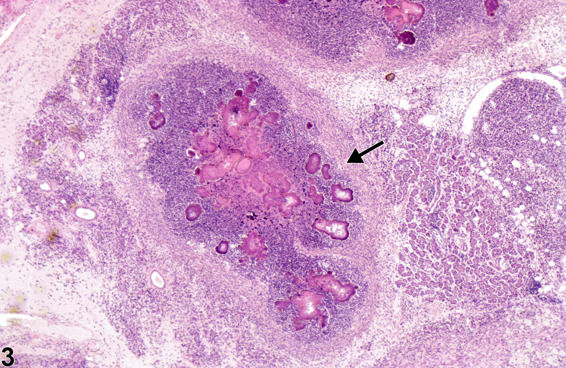 Image of inflammation in the salivary gland from a female B6C3F1 mouse in a chronic study