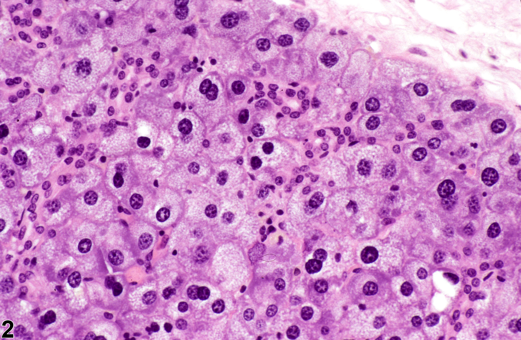 Image of karyomegaly in the salivary gland from a male B6C3F1 mouse in a chronic study