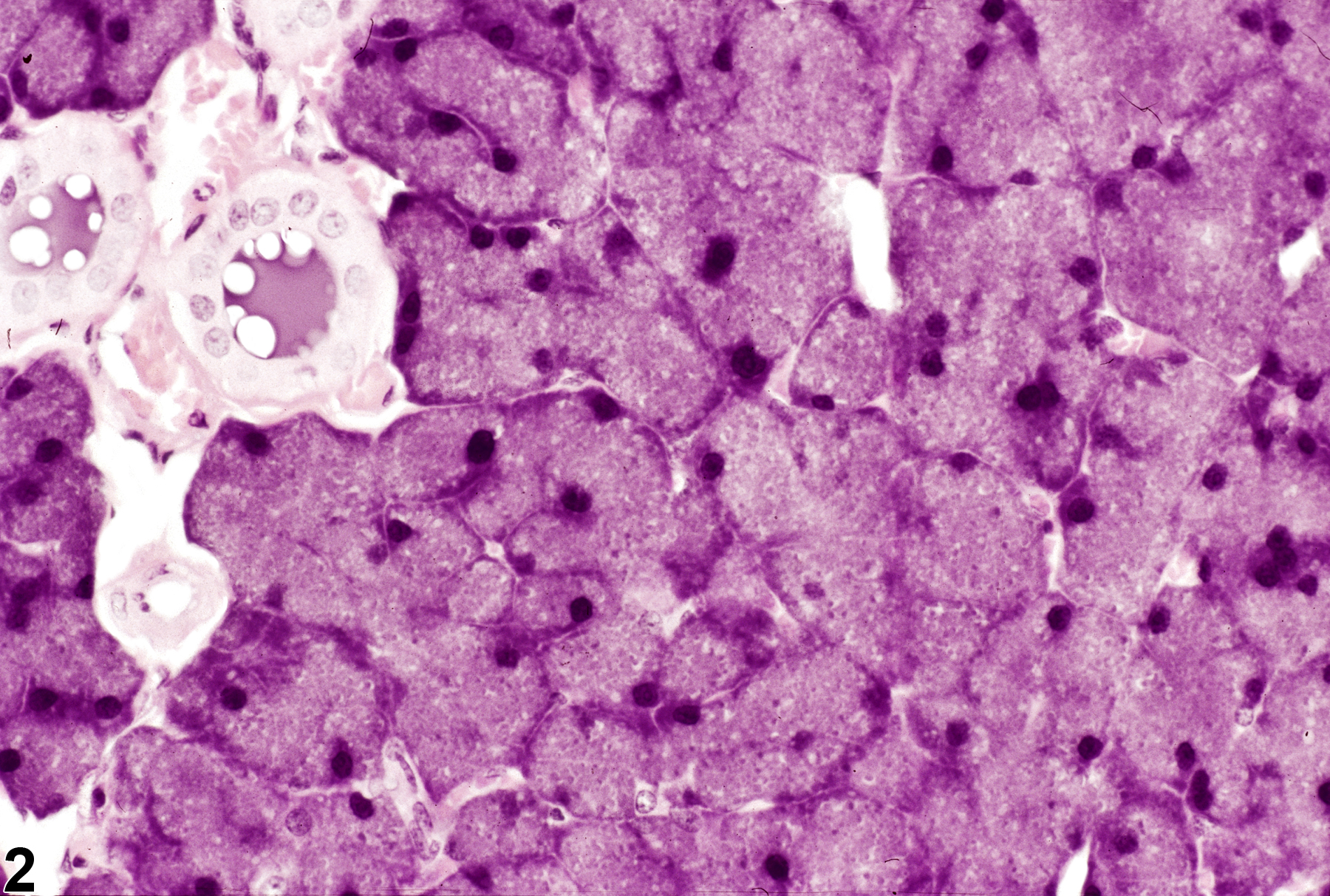 Image of hypertrophy in the parotid salivary gland acinus from a male F344/N rat in a subchronic study