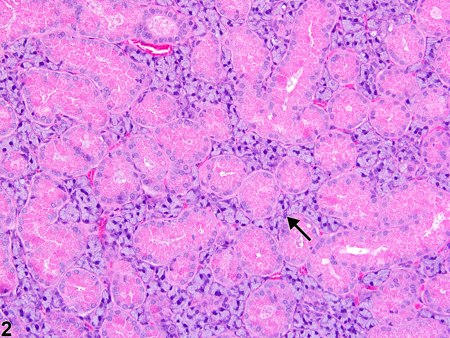 Image of cytoplasmic alteration in the submandibular salivary gland duct from a male B6C3F1 mouse in a chronic study