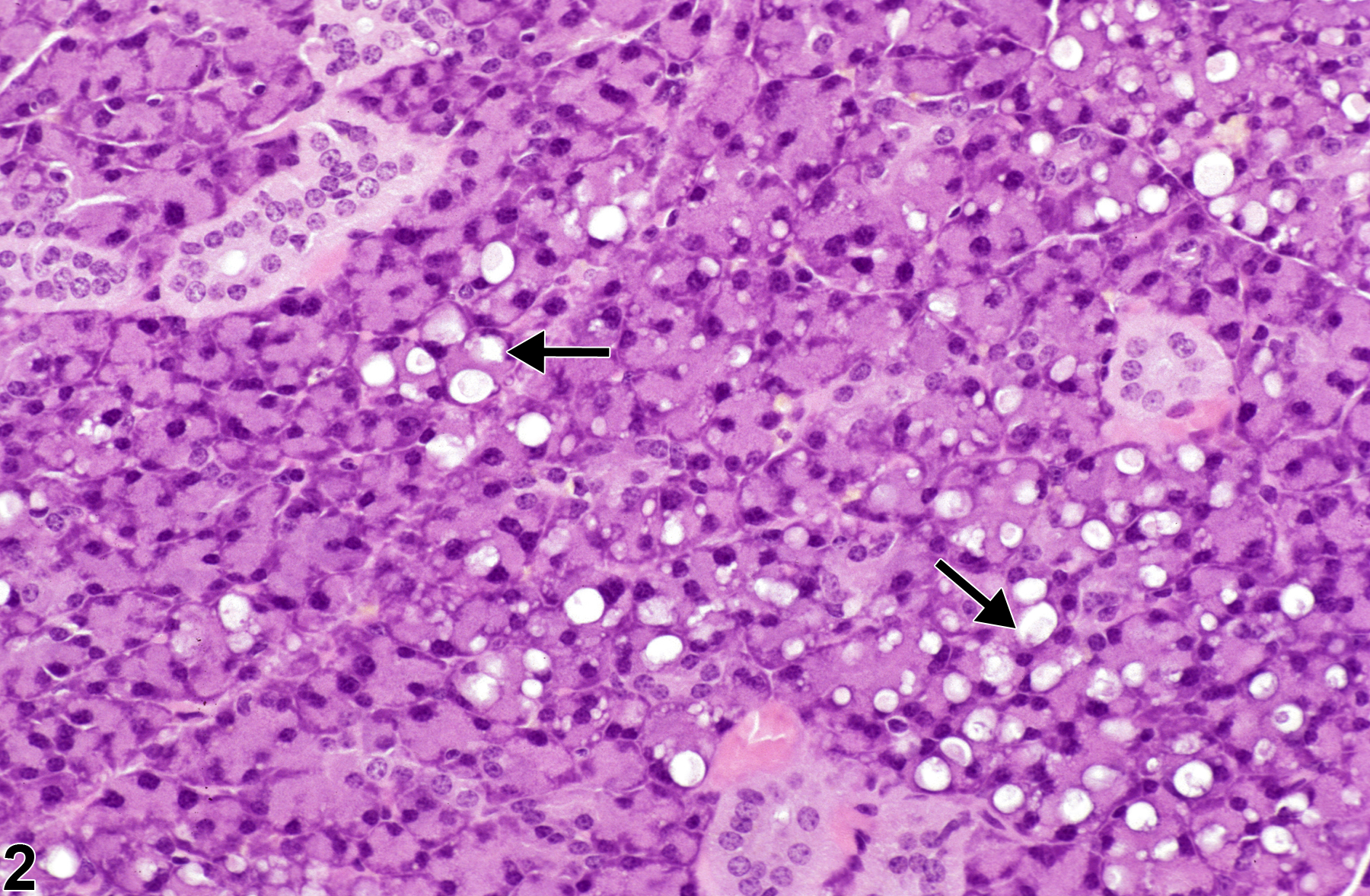 Image of vacuolation, cytoplasmic in the salivary gland from a male B6C3F1 mouse in a chronic study