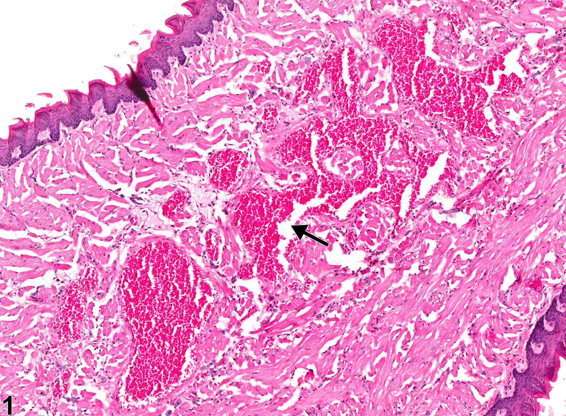 Image of angiectasis in the tongue from a female B6C3F1 mouse in a chronic study