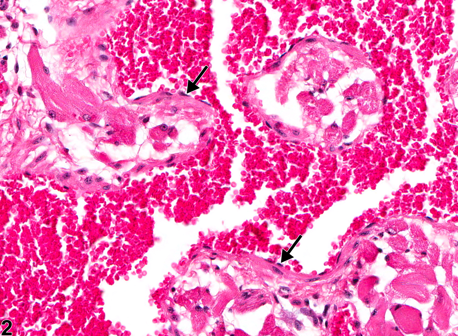 Image of angiectasis in the tongue from a female B6C3F1 mouse in a chronic study