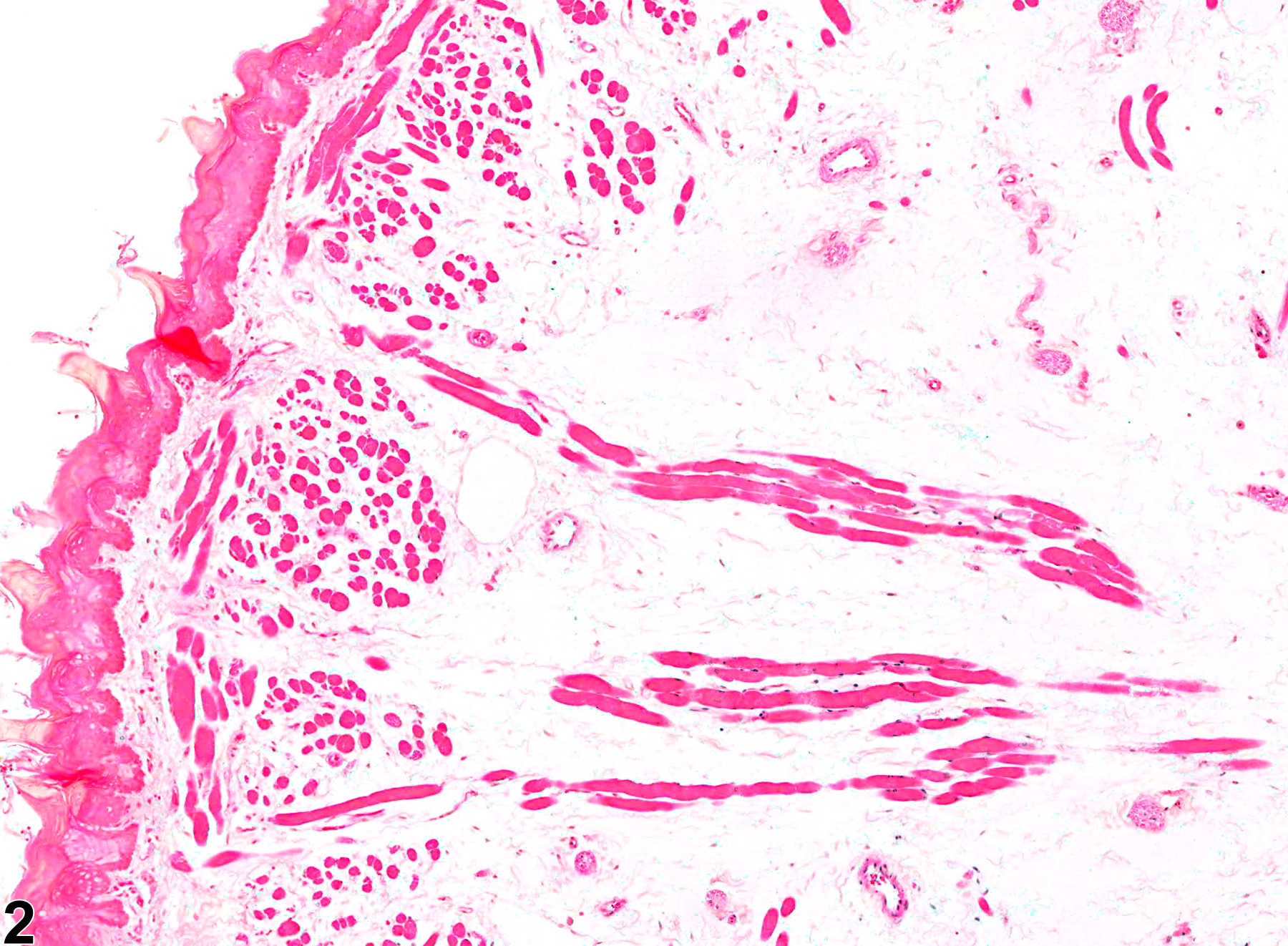 Image of edema in the tongue from a male F344/N rat in a chronic study